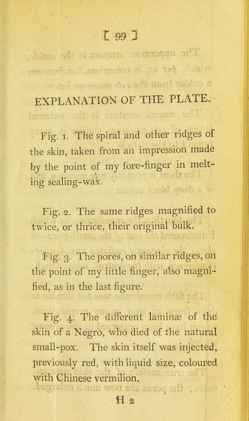 EXPLANATION OF THE PLATE. Fig. l. The spiral and other ridges of the skin, taken from an impression made by the point of my fore-finger in melt- ing sealing-wax. Fig. 2. The same ridges magnified to twice, or thrice, their original bulk. Fig. 3. The pores, on similar ridges, on the point of my little finger, also magni- fied, as in the last figure. Fig. 4. The different lamina? of the skin of a Negro, who died of the natural small-pox. The skin itself was injected, previously red, with liquid size, coloured with Chinese vermilion.