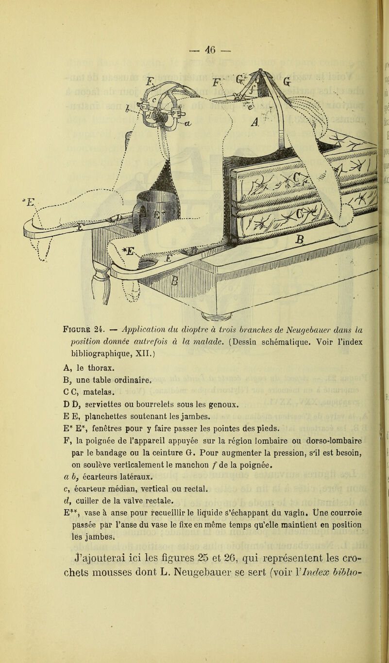 Figure 24. — Application du dioptre à trois branches de Neugebauer dans la position donnée autrefois à la malade. (Dessin schématique. Voir l'index bibliographique, XII.) A, le thorax. B, une table ordinaire. CC, matelas. D D, serviettes ou bourrelets sous les genoux. E E, planchettes soutenant les jambes. E* E*, fenêtres pour y faire passer les pointes des pieds. F, la poignée de l'appareil appuyée sur la région lombaire ou dorso-lombaire par le bandage ou la ceinture G. Pour augmenter la pression, s'il est besoin, on soulève verticalement le manchon f de la poignée. a b3 écarteurs latéraux, e, écarteur médian, vertical ou rectal. d, cuiller de la valve rectale. E**$ vase à anse pour recueillir le liquide s'échappant du vâgm. line courroie passée par l'anse du vase le fixe en même temps qu'elle maintient en position lës jambes; J'ajouterai ici les figures 25 et 26, qui représentent les cro- chets mousses dont L. Neugebauer se sert (voir VIndex biblio-