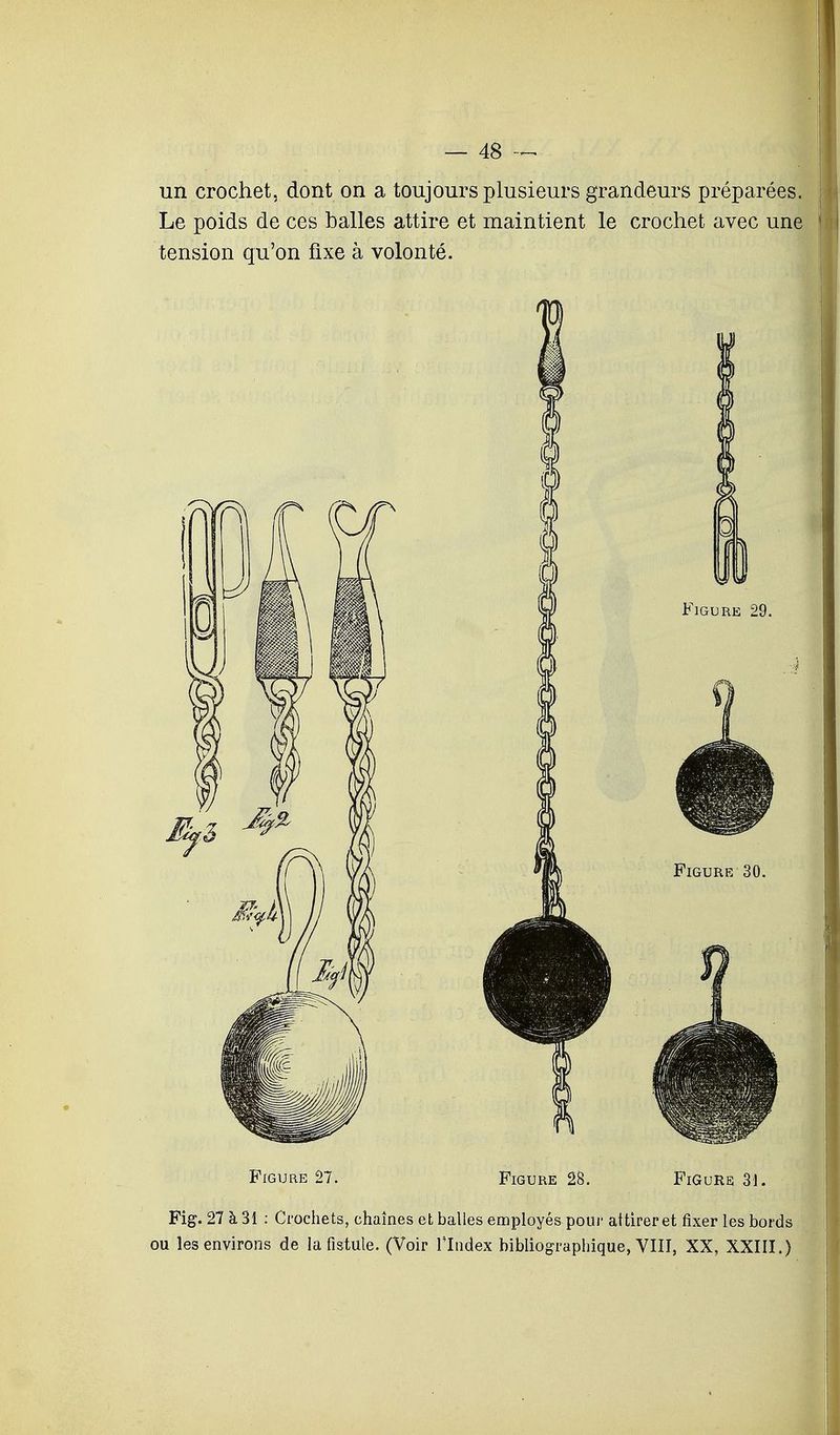 un crochet, dont on a toujours plusieurs grandeurs préparées. Le poids de ces balles attire et maintient le crochet avec une tension qu'on fixe à volonté. Figure 27. Figure 28. Figure 31. Fig. 27 à 31 : Crochets, chaînes et balles employés-pour attirer et fixer les bords ou les environs de la fistule. (Voir l'Index bibliographique, VIII, XX, XXIII.)