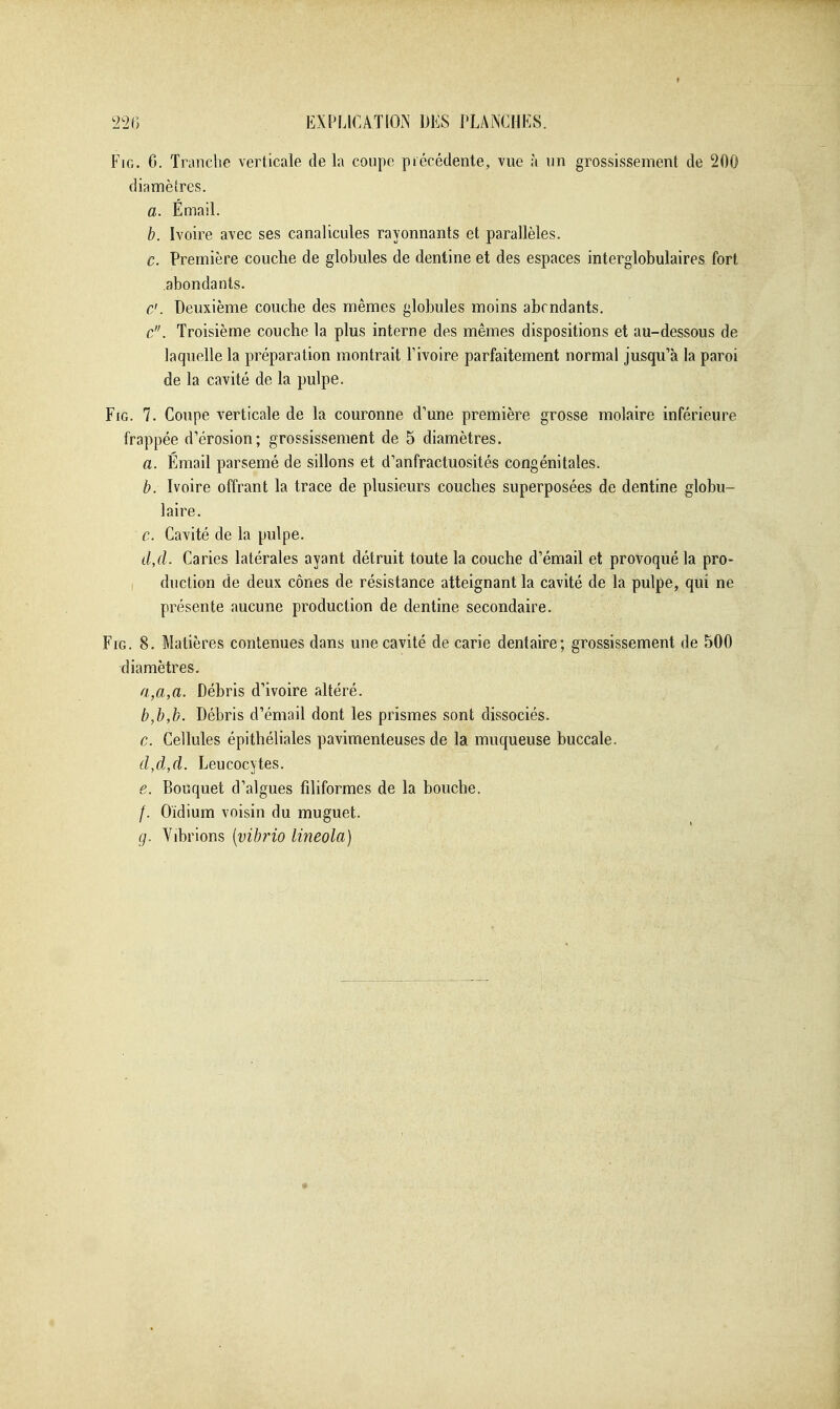 FiG. 6. Tranche verticale de la coupe précédente, vue à un grossissement de 200 diamètres. a. Email. h. Ivoire avec ses canalicules rayonnants et parallèles. c. Première couche de globules de dentine et des espaces interglobulaires fort abondants. c'. Deuxième couche des mêmes globules moins abcndants. c. Troisième couche la plus interne des mêmes dispositions et au-dessous de laquelle la préparation montrait l'ivoire parfaitement normal jusqu'à la paroi de la cavité de la pulpe. FiG. 7. Coupe verticale de la couronne d'une première grosse molaire inférieure frappée d'érosion; grossissement de 5 diamètres. a. Émail parsemé de sillons et d'anfractuosités congénitales. h. Ivoire offrant la trace de plusieurs couches superposées de dentine globu- laire. c. Cavité de la pulpe. cl,(l. Caries latérales ayant détruit toute la couche d'émail et provoqué la pro- , duction de deux cônes de résistance atteignant la cavité de la pulpe, qui ne présente aucune production de dentine secondaire. FiG. 8. Matières contenues dans une cavité de carie dentaire; grossissement de 500 diamètres, a, a,a. Débris d'ivoire altéré. b, b,b. Débris d'émail dont les prismes sont dissociés. c, Cellules épithéliales pavimenteuses de la muqueuse buccale. d, d,d. Leucocytes. e, Bouquet d'algues filiformes de la bouche. /. Oïdium voisin du muguet. g. Vibrions [vibrio lineola)