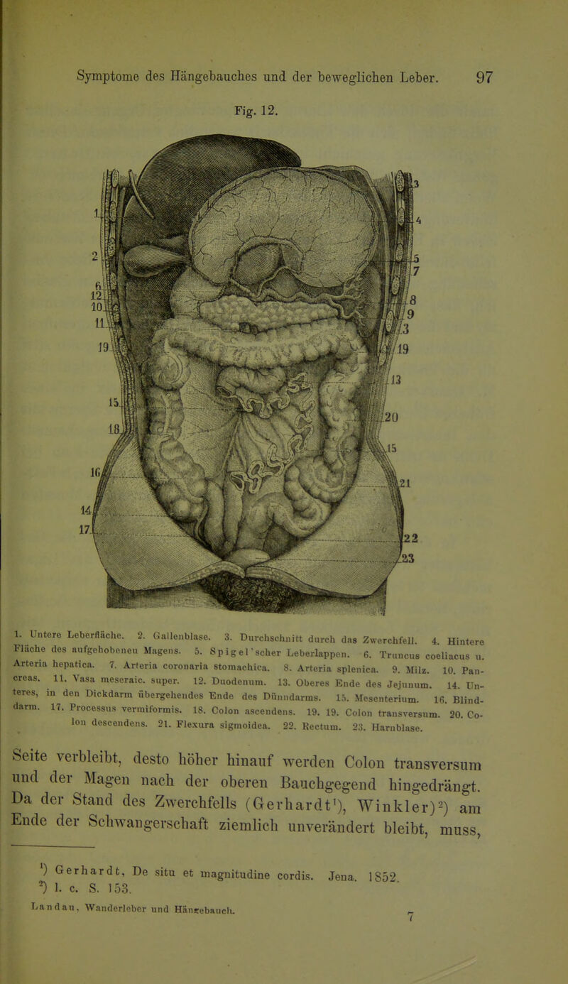 Fig. 12. 1. Untere Leberfläche. 2. Gallenblase. 3. Durchschnitt durch das Zwerchfell. 4 Hintere Fläche des aufgehobeneu Magens. 5. SpigeKscher Leberlappen. 6. Truncus coeliacus u. Artena hepatica. 7. Arteria coronaria stomachica. 8. Arteria splenica. 9. Milz. 10. Pan- creas. 11. Vasa meseraic. super. 12. Duodenum. 13. Oberes Ende des Jejnnum. U. Un- teres, in den Dickdarm übergehendes Ende des Dünndarms. Ih. Mesenterium. 16 Blind- darm. 17. Processus vermiformis. 18. Colon ascendens. 19. 19. Colon transversum. 20. Co- lon descendens. 21. Flexura sigmoidea. 22. Rectum. 23. Harnblase. Seite verbleibt, desto höher hinauf werden Colon transversum und der Magen nach der oberen Bauchgegend hingedrängt. Da der Stand des Zwerchfells (Gerhardt'), Winkler)^) am Ende der Schwangerschaft ziemlich unverändert bleibt, muss, 0 Gerhardt, De situ et magnitudine cordis. Jena. 1852 ') I. c. S. 153. Landau. Wanderleber und Hänsebanclu