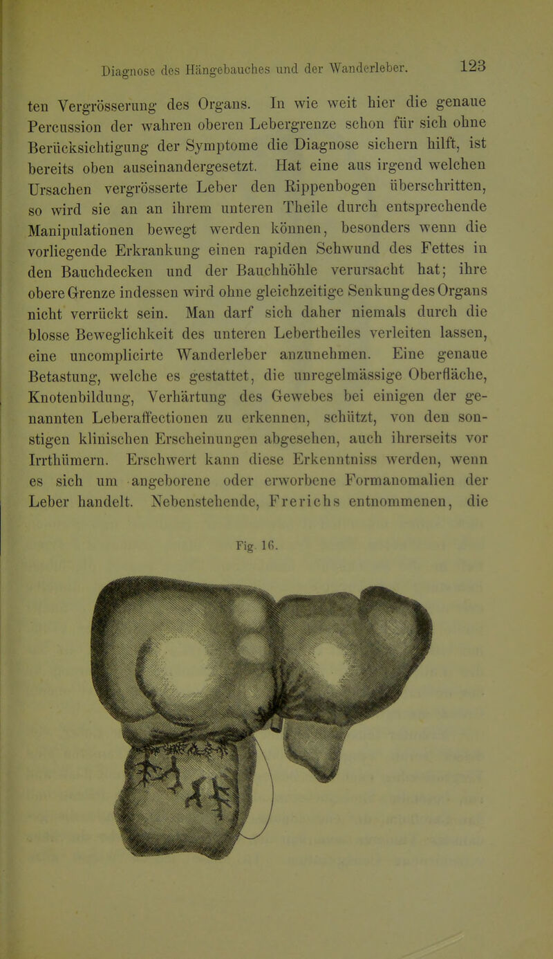 teil VergTÖsserung des Organs. In wie weit hier die genaue Percussion der wahren oberen Lebergrenze schon für sich ohne Berücksichtigung der Symptome die Diagnose sichern hilft, ist bereits oben auseinandergesetzt. Hat eine aus irgend welchen Ursachen vergrösserte Leber den Rippenbogen überschritten, so wird sie an an ihrem unteren Theile durch entsprechende Manipulationen bewegt werden können, besonders wenn die vorliegende Erkrankung einen rapiden Schwund des Fettes in den Bauchdecken und der Bauchhöhle verursacht hat; ihre obere Grenze indessen wird ohne gleichzeitige Senkung des Organs nicht verrückt sein. Man darf sich daher niemals durch die blosse Beweglichkeit des unteren Lebertheiles verleiten lassen, eine uncomplicirte Wanderleber anzunehmen. Eine genaue Betastung, welche es gestattet, die unregelmässige Oberfläche, Knotenbildung, Verhärtung des Gewebes bei einigen der ge- nannten Leberaffectionen zu erkennen, schützt, von den son- stigen klinischen Erscheinungen abgesehen, auch ihrerseits vor Irrthümern. Erschwert kann diese Erkenntniss werden, wenn es sich um angeborene oder erworbene Formanomalien der Leber handelt. Nebenstehende, Frerichs entnommenen, die