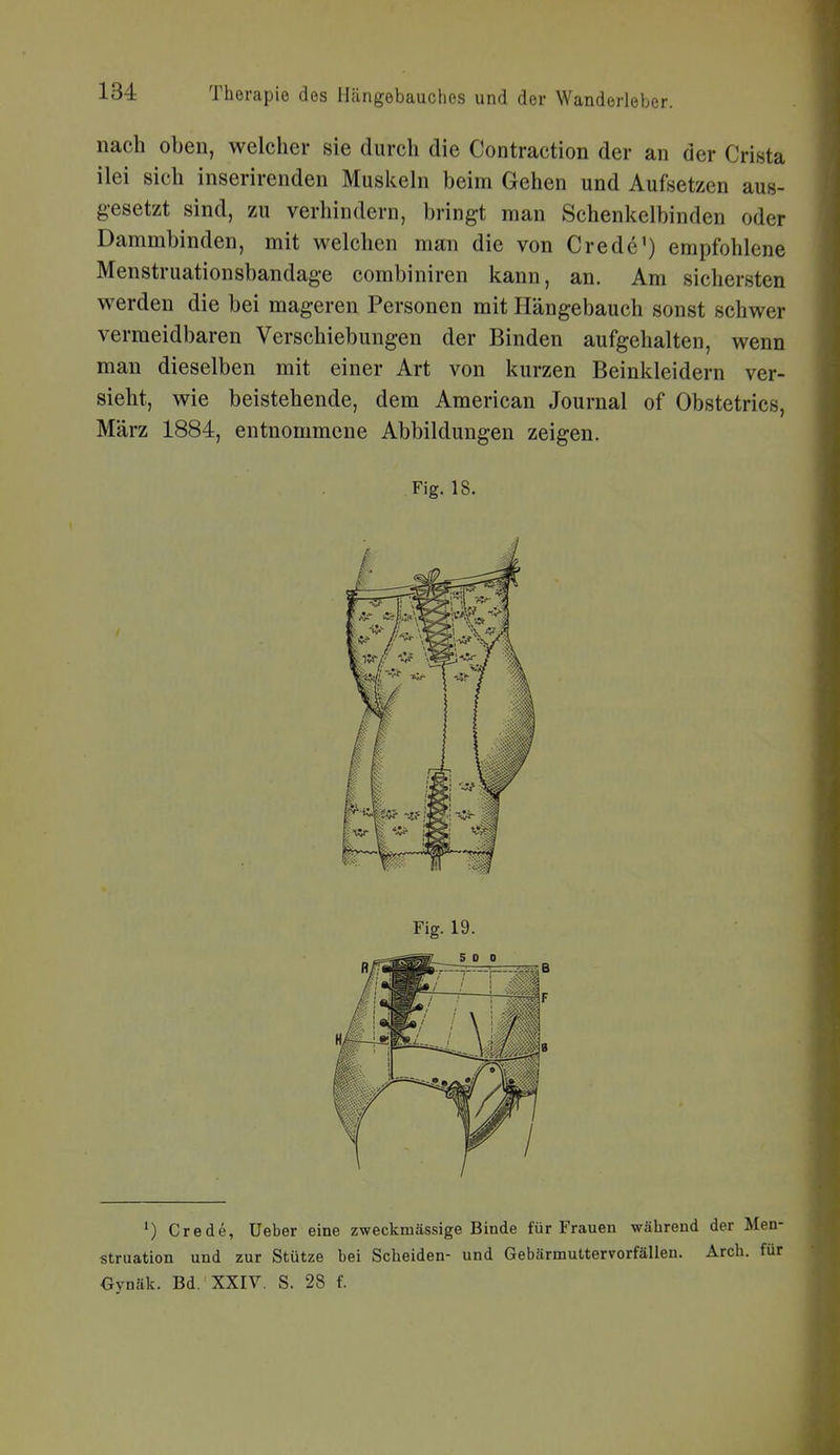 nach oben, welcher sie durch die Contraction der an der Crista ilei sich inserirenden Muskeln beim Gehen und Aufsetzen aus- gesetzt sind, zu verhindern, bringt man Schenkelbinden oder Dammbinden, mit welchen man die von Crede') empfohlene Menstruationsbandage combiniren kann, an. Am sichersten werden die bei mageren Personen mit Hängebauch sonst schwer vermeidbaren Verschiebungen der Binden aufgehalten, wenn man dieselben mit einer Art von kurzen Beinkleidern ver- sieht, wie beistehende, dem American Journal of Obstetrics, März 1884, entnommene Abbildungen zeigen. Fig. 18. ^) Crede, lieber eine zweckmässige Binde für Frauen während der Men- struation und zur Stütze bei Scheiden- und Gebärmuttervorfällen. Arch. für Oynäk. Bd. XXIV. S. 28 f.