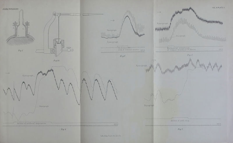 oresL of artificial respiration. ...it.mi iimii I Fig-4. Arrest of artif resp LitK.S.Imp.Cam'b. Sci.InstCo