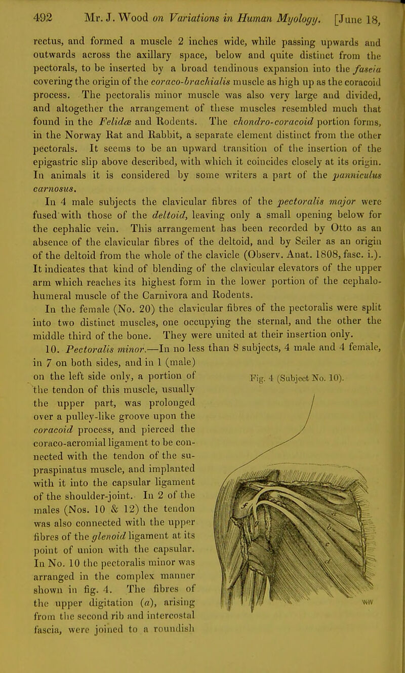 rectus, and formed a muscle 2 inches wide, while passing upwards and outwards across the axillary space, below and quite distinct from the pectorals, to be inserted by a broad tendinous expansion into the fastia covering the origin of the coraco-bi-achialis muscle as high up as the coracoid process. The pectoralis minor muscle was also very large and divided, and altogether the arrangement of these muscles resembled much that found in the Felidcs and llodents. The chondro-coracoid \)Or\!\on forms, in the Norway Rat and Rabbit, a separate clement distinct from the other pectorals. It seems to be an upward transition of the insertion of the epigastric slip above described, with which it coincides closely at its origin. In animals it is considered by some writers a part of the paiiniculus carnosus. In 4 male subjects the clavicular fibres of the pectoralis major were fused with those of the deltoid, leaving only a small opening below for the cephalic vein. This arrangement has been recorded by Otto as an absence of the clavicular fibres of the deltoid, and by Seller as an origin of the deltoid from the whole of the clavicle (Observ. Anat. 1808, fasc. i.). It indicates that kind of blending of the clavicular elevators of the upper arm which reaches its highest form in the lower portion of the cephalo- humeral muscle of the Carnivora and Rodents. In the female (No. 20) the clavicular fibres of the pectoralis were split into two distinct muscles, one occupying the sternal, and the other the middle third of the bone. They were united at their insertion only. 10. Pectoralis minor.—In no less than 8 subjects, 4 male and 4 female, in 7 on both sides, and in 1 (male) on the left side only, a portion of Y\g. 4 (Subject No. 10). the tendon of this muscle, usually the upper part, was prolonged over a pulley-like groove upon the coracoid process, and pierced the coraco-acromial ligament to be con- nected with the tendon of the su- praspinatus muscle, and implanted with it into the capsular ligament of the shoulder-joint. In 2 of the males (Nos. 10 & 12) the tendon was also connected with the upper fibres of the glenoid ligament at its point of union with the capsular. In No. 10 the pectoralis minor was arranged in the complex manner shown in fig. 4. The fibres of the upper digitation (a), arising from the second rib and intercostal fascia, were joined to a roundish