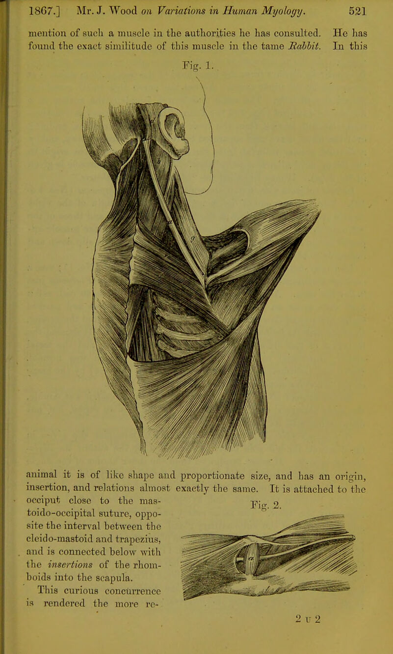 mention of sucli a muscle in the authorities he has consulted. He has found the exact similitude of this muscle iu the tame Mdbhit. In this Pig. 1. animal it is of like shape and proportionate size, and has an origin, insertion, and relations almost exactly the same. It is attached to the occiput close to the mas- toido-occipital suture, oppo- site the interval between the cleido-mastoid and trapezitis, and is connected below with the insertions of the rhom- boids into the scapula. This curious concurrence is rendered the more re-