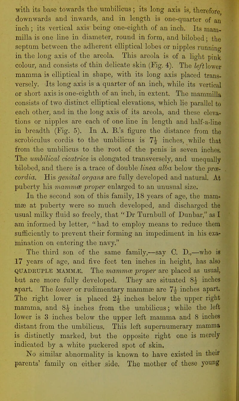 witli its base towards the umbilicus; its long axis is, therefore downwards and inwards, and in length is one-quarter of an inch ; its vertical axis being one-eighth of an inch. Its mam- milla is one line in diameter, round in form, and bilobed; the septum between the adherent elliptical lobes or nipples running in the long axis of the areola. This areola is of a light pink colour, and consists of thin delicate skin (Fig. 4). The left lower mamma is elliptical in shape, with its long axis placed trans- versely. Its long axis is a quarter of an inch, while its vertical or short axis is one-eighth of an inch, in extent. The mammilla consists of two distinct elliptical elevations, which lie parallel to each other, and in the long axis of its areola, and these eleva- tions or nipples are each of one line in length and half-a-line in breadth (Fig. 5). In A. B.'s figure the distance from the scrobicukis cordis to the umbilicus is 7^ inches, while that from the umbilicus to the root of the penis is seven inches. The umbilical cicatrice is elongated transversely, and unequally bilobed, and there is a trace of double linea alba below the prce- cordia. His genital organs are fully developed and natural. At puberty his mammce proper enlarged to an unusual size. In the second son of this family, 18 years of age, the mam- mae at puberty were so much developed, and discharged the usual milky fluid so freely, that  Dr TurnbuU of Dunbar, as I am informed by letter,  had to employ means to reduce them sufficiently to prevent their forming an impediment in his exa- mination on entering the navy. The third son of the same family,—say C. D.,—who is 17 years of age, and five feet ten inches in height, has also QUADRUPLE MAJIM^. The mammce proper are placed as usual, but are more fully developed. They are situated 8J inches apart. The lower or rudimentary mammae are 7^ inches apart. The right lower is placed 2^ inches below the upper right mamma, and 8^ inches from the umbilicus; while the left lower is 3 inches below the upper left mamma and 8 inches distant from the umbilicus. This left supernumerary mamma is distinctly marked, but the opposite right one is merely indicated by a white puckered spot of skin. No similar abnormality is known to have existed in their parents' family on either side. The mother of these young