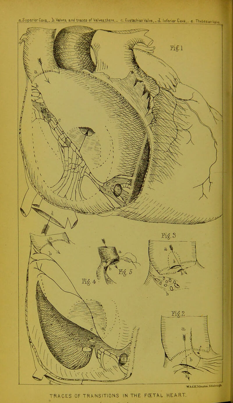 a.SupBriiirCa.va,- l.Valvna, and traces of ValvM.there,- c. EutttchianVaJve,-d Inferior Cava,, e. ThebesijjiVal»e TRACES QF TRANSITIONS IN THE FCETAL HEART.