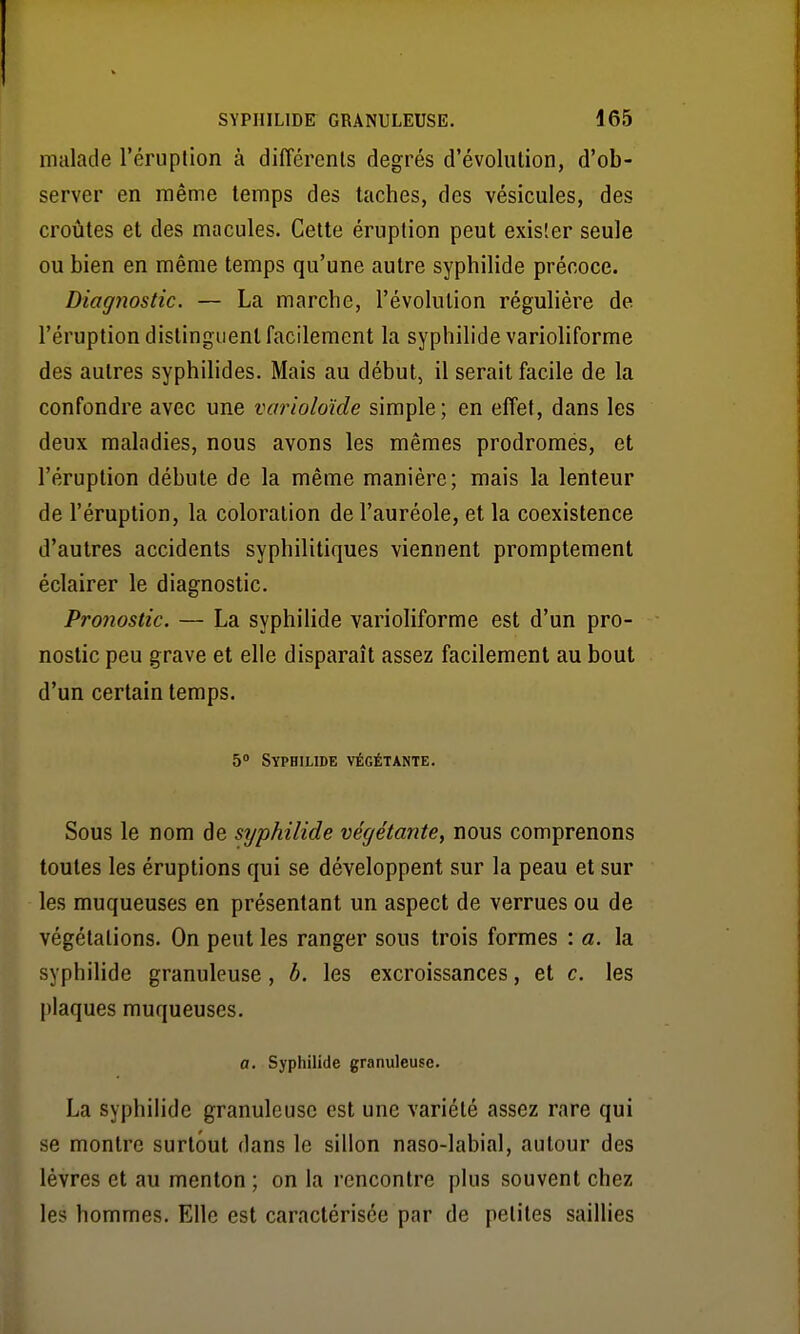 malade l'éruplion à différents degrés d'évolution, d'ob- server en même temps des taches, des vésicules, des croûtes et des macules. Cette éruption peut exister seule ou bien en même temps qu'une autre syphilide précoce. Diagnostic. — La marche, l'évolution régulière de l'éruption distinguent facilement la syphilide varioliforme des autres syphilides. Mais au début, il serait facile de la confondre avec une variolo'ide simple ; en effet, dans les deux maladies, nous avons les mêmes prodromés, et l'éruption débute de la même manière; mais la lenteur de l'éruption, la coloration de l'auréole, et la coexistence d'autres accidents syphilitiques viennent promptement éclairer le diagnostic. Pronostic. — La syphilide varioliforme est d'un pro- nostic peu grave et elle disparaît assez facilement au bout d'un certain temps. 5° Syphilide végétante. Sous le nom de sijphilide végétante, nous comprenons toutes les éruptions qui se développent sur la peau et sur les muqueuses en présentant un aspect de verrues ou de végétations. On peut les ranger sous trois formes : a. la syphilide granuleuse, b. les excroissances, et c. les plaques muqueuses. a. Syphilide granuleuse. La syphilide granuleuse est une variété assez rare qui se montre surtout dans le sillon naso-labial, autour des lèvres et au menton ; on la rencontre plus souvent chez les hommes. Elle est caractérisée par de petites saillies