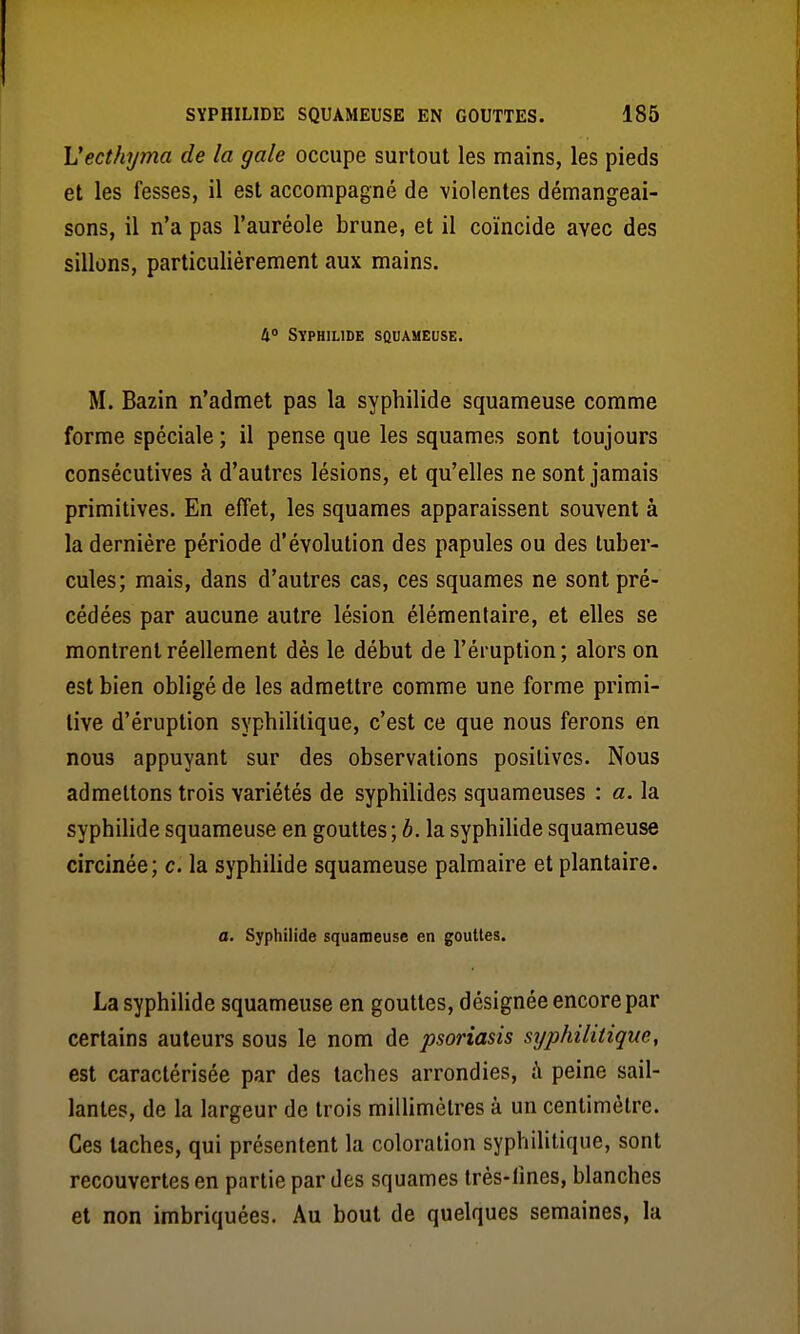 Vecthyma de la gale occupe surtout les mains, les pieds et les fesses, il est accompagné de violentes démangeai- sons, il n'a pas l'auréole brune, et il coïncide avec des sillons, particulièrement aux mains. 4» SYPHILIDE SQUAMEUSE. M. Bazin n'admet pas la syphilide squameuse comme forme spéciale ; il pense que les squames sont toujours consécutives à d'autres lésions, et qu'elles ne sont jamais primitives. En effet, les squames apparaissent souvent à la dernière période d'évolution des papules ou des tuber- cules; mais, dans d'autres cas, ces squames ne sont pré- cédées par aucune autre lésion élémentaire, et elles se montrent réellement dès le début de l'éruption; alors on est bien obligé de les admettre comme une forme primi- tive d'éruption syphilitique, c'est ce que nous ferons en nous appuyant sur des observations positives. Nous admettons trois variétés de syphilides squameuses : a. la syphilide squameuse en gouttes ; b. la syphilide squameuse circinée; c. la syphilide squameuse palmaire et plantaire. a. Syphilide squameuse en gouttes. La syphiHde squameuse en gouttes, désignée encore par certains auteurs sous le nom de psoriasis stjphilitique, est caractérisée par des taches arrondies, à peine sail- lantes, de la largeur de trois millimètres à un centimètre. Ces taches, qui présentent la coloration syphilitique, sont recouvertes en partie par des squames Irès-lînes, blanches et non imbriquées. Au bout de quelques semaines, la