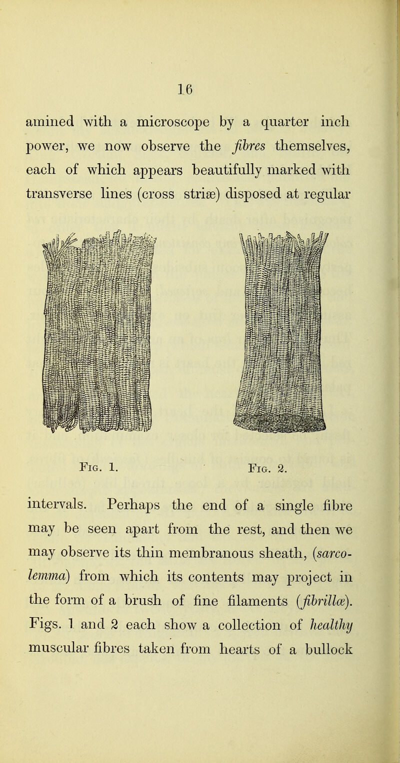 amined with a microscope by a quarter inch power, we now observe the fibres themselves, each of which appears beautifully marked with transverse lines (cross striae) disposed at regular Fig. 1. ~ Fig. 2. intervals. Perhaps the end of a single fibre may be seen apart from the rest, and then we may observe its thin membranous sheath, {sarco- lemma) from which its contents may project in the form of a brush of fine filaments (fihrillce). Figs. 1 and 2 each show a collection of healthy muscular fibres taken from hearts of a bullock