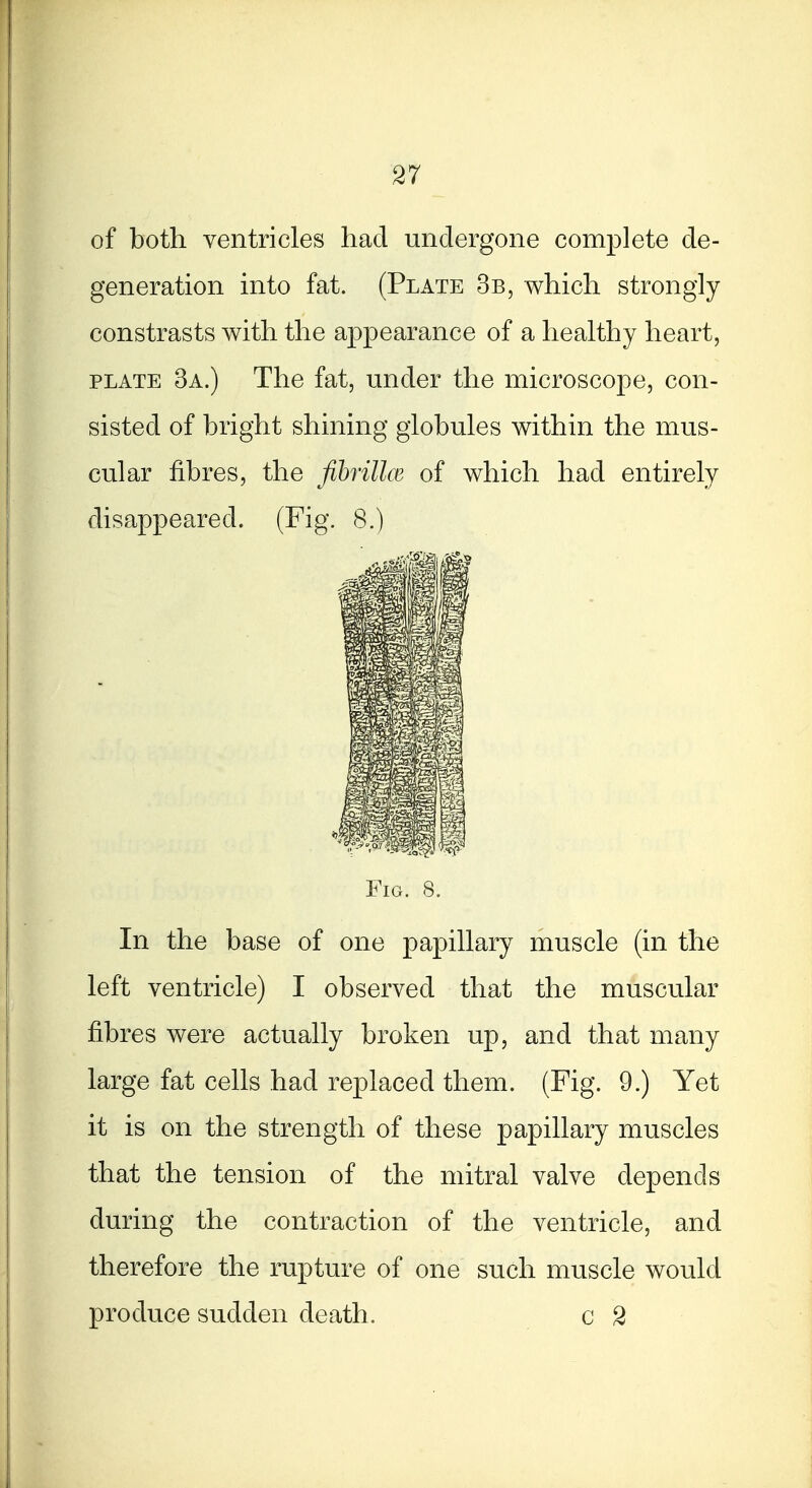 of both ventricles had undergone complete de- generation into fat. (Plate 3b, which strongly constrasts with the appearance of a healthy heart, PLATE 3a.) The fat, under the microscope, con- sisted of bright shining globules within the mus- cular fibres, the fihrilke of which had entirely disappeared. (Fig. 8.) Fig. 8. In the base of one papillary muscle (in the left ventricle) I observed that the muscular fibres were actually broken up, and that many large fat cells had replaced them. (Fig. 9.) Yet it is on the strength of these papillary muscles that the tension of the mitral valve depends during the contraction of the ventricle, and therefore the rupture of one such muscle would produce sudden death. c 2
