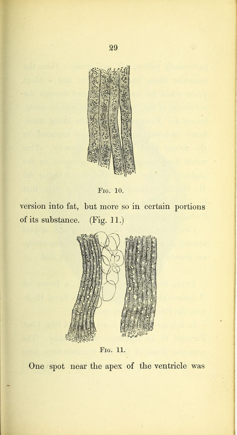 Fig. 10. version into fat, but more so in certain portions of its substance. (Fig. 11.) Fig. 11. One spot near the apex of the ventricle was