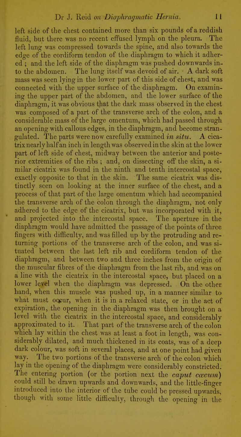 left side of the chest contained more than six pounds of a reddish fluid, but there was no recent effused lymph on the pleura. The left lung was compressed towards the spine, and also towards the edge of the cordiform tendon of the diaphragm to which it adher- ed ; and the left side of the diaphragm was pushed downwards in- to the abdomen. The lung itself was devoid of air. A dark soft mass was seen lying in the lower part of this side of chest, and was connected with the upper surface of the diaphragm. On examin- ing the upper part of the abdomen, and the lower surface of the diaphragm, it was obvious that the dark mass observed in the chest was composed of a part of the transverse arch of the colon, and a considerable mass of the large omentum, which had passed through an opening with callous edges, in the diaphragm, and become stran- gulated. The parts were now carefully examined hi situ. A cica^ trix nearly half an inch in length was observed in the skin at the lower part of left side of chest, midway between the anterior and poste- rior extremities of the ribs ; and, on dissecting off the skin, a si- milar cicatrix was found in the ninth and tenth intercostal space, exactly opposite to that in the skin. The same cicatrix was dis- tinctly seen on looking at the inner surface of the chest, and a process of that part of the large omentum which had accompanied the transverse arch of the colon through the diaphragm, not only adhered to the edge of the cicatrix, but was incorporated with it, and projected into the intercostal space. The aperture in the diaphragm would have admitted the passage of the points of three fingers with difficulty, and was filled up by the protruding and re- turning portions of the transverse arch of the colon, and was si- tuated between the last left rib and cordiform tendon of the diaphragm, and between two and three inches from the origin of the muscular fibres of t!ie diaphragm from the last rib, and was on a line with the cicatrix in the intercostal space, but placed on a lower level when the diaphragm was depressed. On the other hand, when this muscle was pushed up, in a manner similar to what must oq(:ur, when it is in a relaxed state, or in the act of expiration, the opening in the diaphragm was then brought on a level with the cicatrix in the intercostal space, and considerably approximated to it. That part of the transverse arch of the colon which lay within the chest was at least a foot in length, was con- siderably dilated, and much thickened in its coats, was of a deep dark colour, was soft in several places, and at one point had given way. The two portions of the transverse arch of the colon which lay in the opening of the diaphragm were considerably constricted. The entering portion (or the portion next the caput cwcum) could still be drawn upwards and downwards, and the little-finger introduced into the interior of the tube could be pressed upwards, though with some little difficulty, through the opening in the