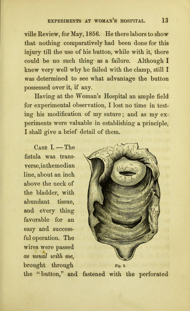 ville Review, for May, 1856. He there labors to show that nothing comparatively had been done for this injury till the use of his button, while with it, there could be no such thing as a failure. Although I knew very well why he failed with the clamp, still I was determined to see what advantage the button possessed over it, if any. Having at the Woman's Hospital an ample field for experimental observation, I lost no time in test- ing his modification of my suture; and as my ex- periments were valuable in establishing a principle, I shall give a brief detail of them. Case L —The fistula was trans- verse,inthemedian line, about an inch above the neck of the bladder, with abundant tissue, and every thing favorable for an easy and success- ful operation. The wires were passed as usual with me^ brought through Fig. 3. the button, and fastened with the perforated