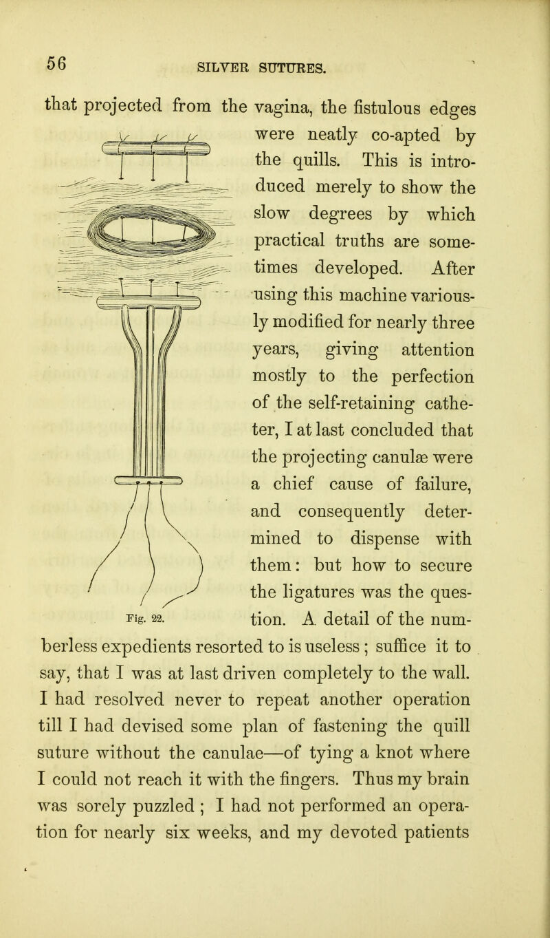 that projected from the vagina, the fistulous edges were neatly co-apted by the quills. This is intro- duced merely to show the slow degrees by which practical truths are some- times developed. After using this machine various- ly modified for nearly three years, giving attention mostly to the perfection of the self-retaining cathe- ter, I at last concluded that the projecting canulae were a chief cause of failure, and consequently deter- mined to dispense with them: but how to secure the ligatures was the ques- tion. A detail of the num- berless expedients resorted to is useless ; suffice it to say, that I was at last driven completely to the wall. I had resolved never to repeat another operation till I had devised some plan of fastening the quill suture without the canulae—of tying a knot where I could not reach it with the fingers. Thus my brain was sorely puzzled ; I had not performed an opera- tion for nearly six weeks, and my devoted patients