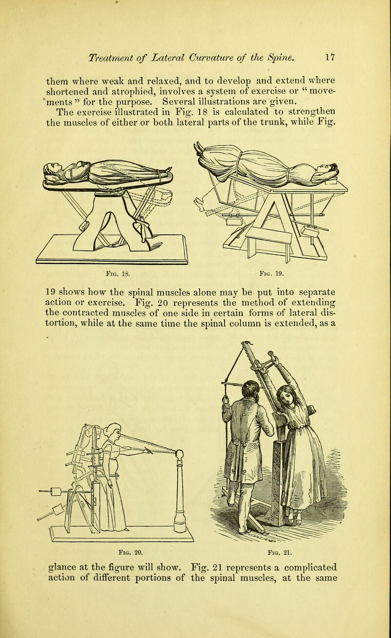 them where weak and relaxed, and to develop and extend where shortened and atrophied, involves a system of exercise or  move- 'ments  for the purpose. Several illustrations are given. The exercise illustrated in Fig. 18 is calculated to strengthen the muscles of either or both lateral parts of the trunk, while Fig. Fig. 18. Fig. 19. 19 shows how the spinal muscles alone may be put into separate action or exercise. Fig. 20 represents the method of extending the contracted muscles of one side in certain forms of lateral dis- tortion, while at the same time the spinal column is extended, as a glance at the figure will show. Fig. 21 represents a complicated action of different portions of the spinal muscles, at the same