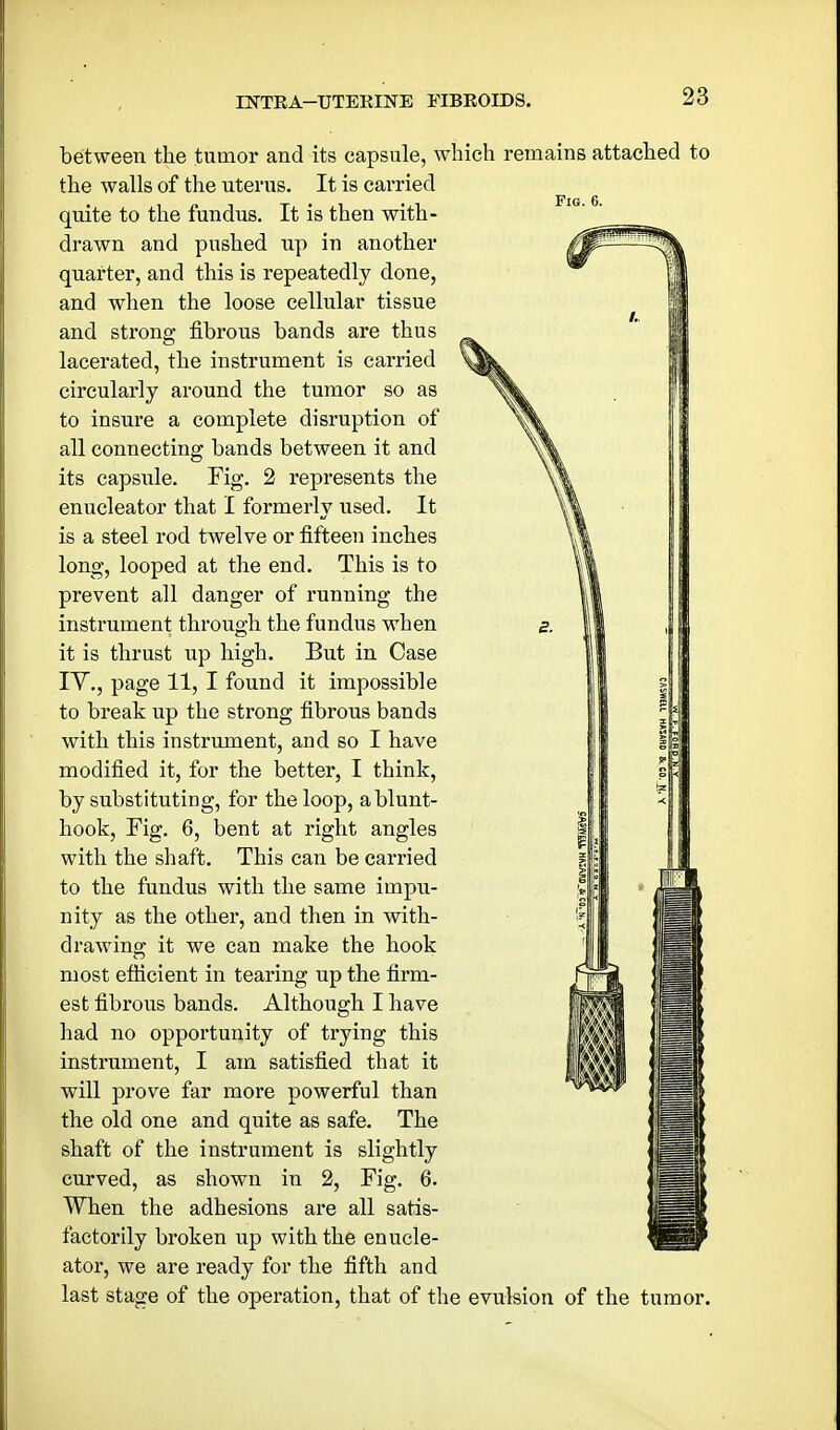 between the tumor and its capsule, which remains attached to the walls of the uterus. It is carried quite to the fundus. It is then with- drawn and pushed up in another quarter, and this is repeatedly done, and when the loose cellular tissue and strong fibrous bands are thus lacerated, the instrument is carried circularly around the tumor so as to insure a complete disruption of all connecting bands between it and its capsule. Fig. 2 represents the enucleator that I formerly used. It is a steel rod twelve or fifteen inches long, looped at the end. This is to prevent all danger of running the instrument through the fundus when s. it is thrust up high. But in Case lY., page 11, I found it impossible to break up the strong fibrous bands with this instrument, and so I have modified it, for the better, I think, by substituting, for the loop, a blunt- hook, Fig. 6, bent at right angles with the shaft. This can be caiTied to the fundus with the same impu- nity as the other, and then in with- drawing it we can make the hook most eflicient in tearing up the firm- est fibrous bands. Although I have had no opportunity of trying this instrument, I am satisfied that it will prove far more powerful than the old one and quite as safe. The shaft of the instrument is slightly curved, as shown in 2, Fig. 6. When the adhesions are all satis- factorily broken up with the enucle- ator, we are ready for the fifth and last stage of the operation, that of the evulsion of the tumor.