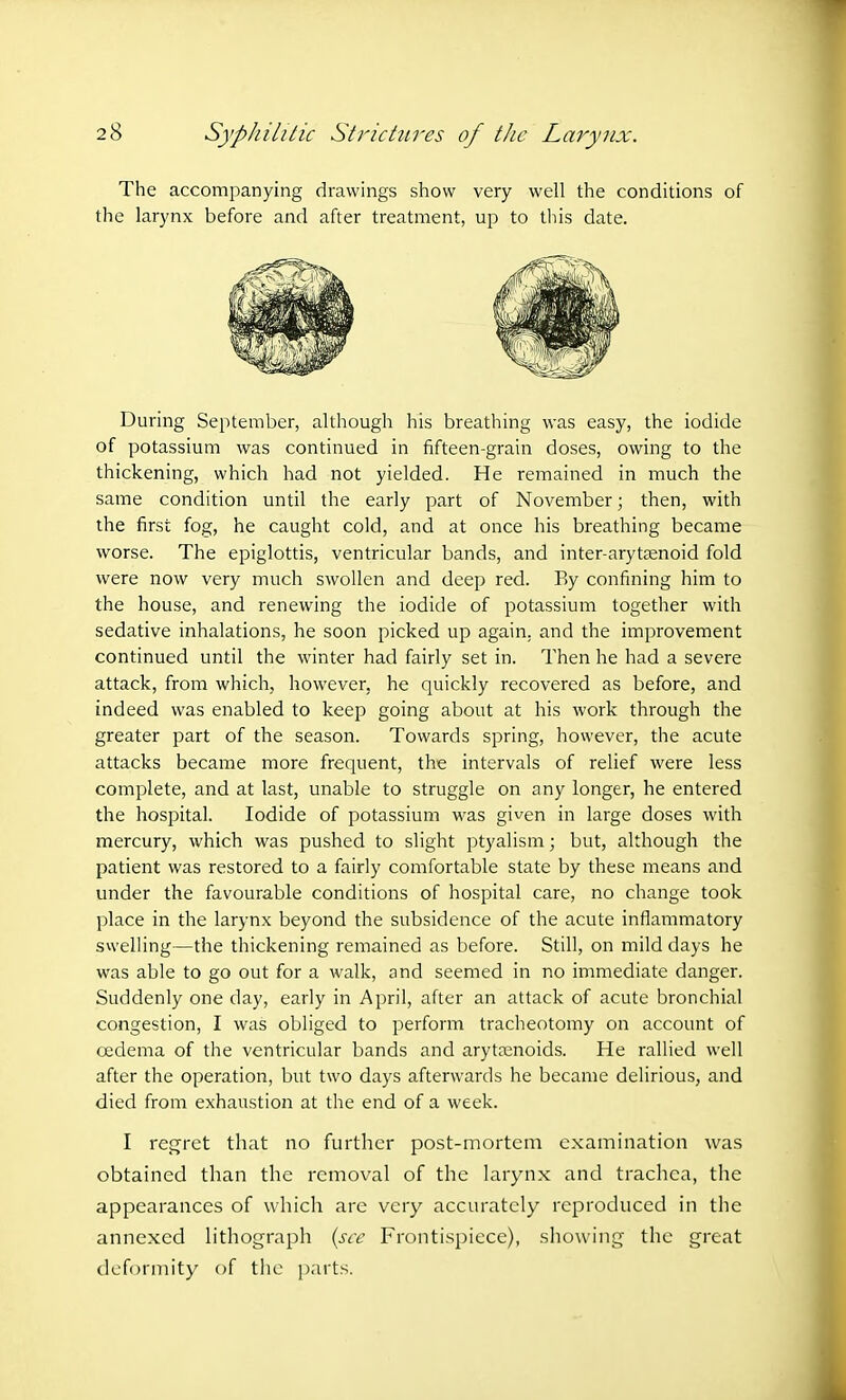 The accompanying drawings show very well the conditions of the larynx before and after treatment, up to this date. During September, although his breathing was easy, the iodide of potassium was continued in fifteen-grain doses, owing to the thickening, which had not yielded. He remained in much the same condition until the early part of November; then, with the first fog, he caught cold, and at once his breathing became worse. The epiglottis, ventricular bands, and inter-arytaenoid fold were now very much swollen and deep red. By confining him to the house, and renewing the iodide of potassium together with sedative inhalations, he soon picked up again, and the improvement continued until the winter had fairly set in. Then he had a severe attack, from which, however, he quickly recovered as before, and indeed was enabled to keep going about at his work through the greater part of the season. Towards spring, however, the acute attacks became more frequent, the intervals of relief were less complete, and at last, unable to struggle on any longer, he entered the hospital. Iodide of potassium was given in large doses with mercury, which was pushed to slight ptyalism; but, although the patient was restored to a fairly comfortable state by these means and under the favourable conditions of hospital care, no change took place in the larynx beyond the subsidence of the acute inflammatory swelling—the thickening remained as before. Still, on mild days he was able to go out for a walk, and seemed in no immediate danger. Suddenly one day, early in April, after an attack of acute bronchial congestion, I was obliged to perform tracheotomy on account of oedema of the ventricular bands and arytenoids. He rallied well after the operation, but two days afterwards he became delirious, and died from exhaustion at the end of a week. I regret that no further post-mortem examination was obtained than the removal of the larynx and trachea, the appearances of which are very accurately reproduced in the annexed lithograph (see Frontispiece), showing the great deformity of the parts.