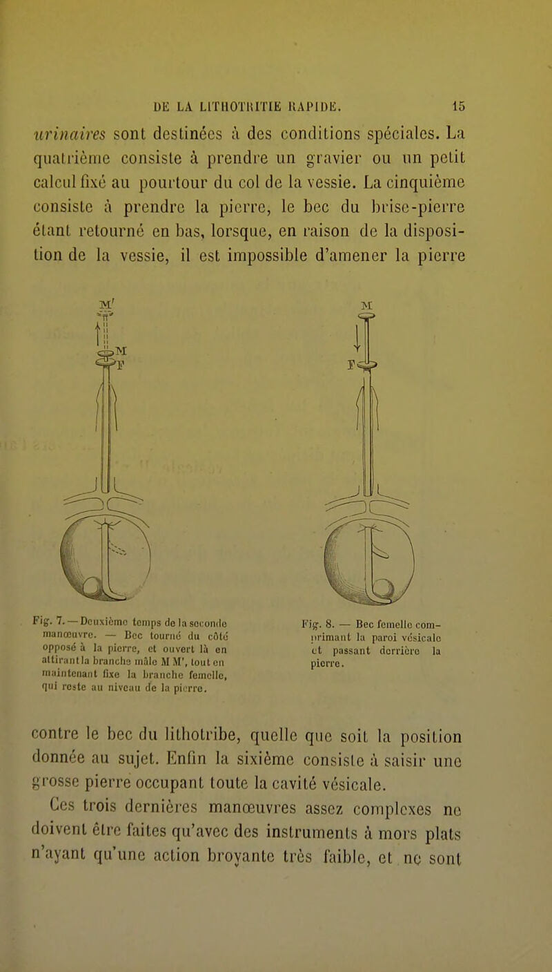 urinaires sont destinées à des conditions spéciales. La quali'iènie consiste à prendre un gravier ou un petit calcul fixé au pourtour du col de la vessie. La cinquième consiste à prendre la pierre, le bec du brise-pierre étant retourné en bas, lorsque, en raison de la disposi- tion de la vessie, il est impossible d'amener la pierre m' m Fig. 7. — Deuxième temps do la soc:oii(lo Pig. 8. — Bec femelle com- manœuvrc. — Bec tourné du côté iwimaiit la paroi vcsicalo opposé à la pierre, et ouvert là en et passant derrière la altirantla branche mâle M iM', touten pierre, maintenant fixe la branche femelle, qui reste au niveau de la piorro. contre le bec du lilhotribe, quelle que soit la position donnée au sujet. Enfin la sixième consiste à saisir une grosse pierre occupant toute la cavité vésicale. Ces trois dernières manœuvres assez complexes ne doivent être faites qu'avec des instruments à mors plats n'ayant qu'une action broyante très laibie, et no sont