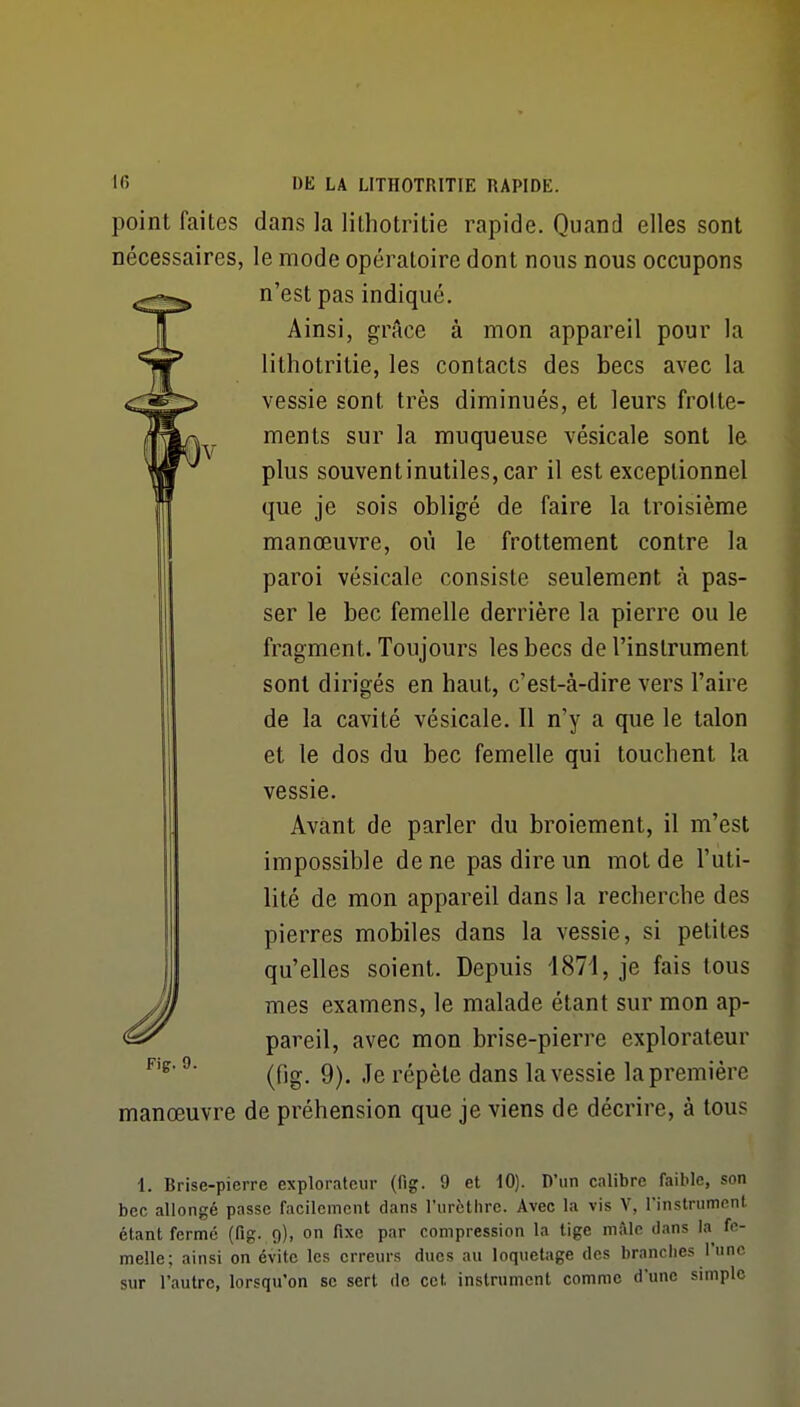 point faites dans la lithotritie rapide. Quand elles sont nécessaires, le mode opératoire dont nous nous occupons n'est pas indiqué. Ainsi, grAce à mon appareil pour la lithotritie, les contacts des becs avec la vessie sont très diminués, et leurs frotte- ments sur la muqueuse vésicale sont le plus souvent inutiles, car il est exceptionnel que je sois obligé de faire la troisième manœuvre, où le frottement contre la paroi vésicale consiste seulement à pas- ser le bec femelle derrière la pierre ou le fragment. Toujours les becs de l'instrument sont dirigés en haut, c'est-à-dire vers l'aire de la cavité vésicale. Il n'y a que le talon et le dos du bec femelle qui touchent la vessie. Avant de parler du broiement, il m'est impossible de ne pas dire un mot de l'uti- lité de mon appareil dans la recherche des pierres mobiles dans la vessie, si petites qu'elles soient. Depuis 1871, je fais tous mes examens, le malade étant sur mon ap- pareil, avec mon brise-pierre explorateur (fig. 9). Je répète dans la vessie la première manœuvre de préhension que je viens de décrire, à tous 1. Brise-pierre explorateur (fig. 9 et 10). D'un calibre faible, son bec allongé passe facilement dans l'urcthrc. Avec la vis V, l'instnimcnt étant fermé (fig- 9), on fixe par compression la tige mâle dans la fe- melle; ainsi on évite les erreurs ducs au loquetage des branches l'une sur l'autre, lorsqu'on se sert do cet instrument comme d'une simple