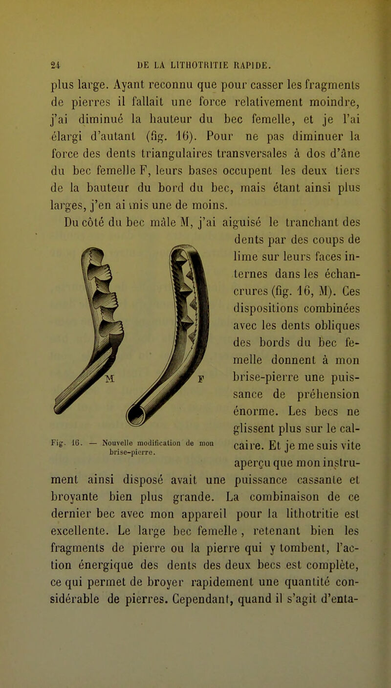 plus large. Ayant reconnu que pour casser les fragments de pierres il fallait une force relativement moindre, j'ai diminué la hauteur du bec femelle, et je l'ai élargi d'autant (fig. 16). Pour ne pas diminuer la force des dents triangulaires transversales à dos d'âne du bec femelle F, leurs bases occupent les deux tiers de la bauteur du bord du bec, mais étant ainsi plus larges, j'en ai mis une de moins. Du côté du bec mâle M, j'ai aiguisé le tranchant des dents par des coups de lime sur leurs faces in- ternes dans les échan- crures (fig. 16, M). Ces dispositions combinées avec les dents obhques des bords du bec fe- melle donnent à mon brise-pierre une puis- sance de préhension énorme. Les becs ne glissent plus sur le cal- caire. Et je me suis vite aperçu que mon instru- ment ainsi disposé avait une puissance cassante et broyante bien plus grande. La combinaison de ce dernier bec avec mon appareil pour la litliotritie est excellente. Le large bec femelle , retenant bien les fragments de pierre ou la pierre qui y tombent, l'ac- tion énergique des dents des deux becs est complète, ce qui permet de broyer rapidement une quantité con- sidérable de pierres. Cependant, quand il s'agit d'enta- Fig. 16. Nouvelle modification de mon brise-pierre.