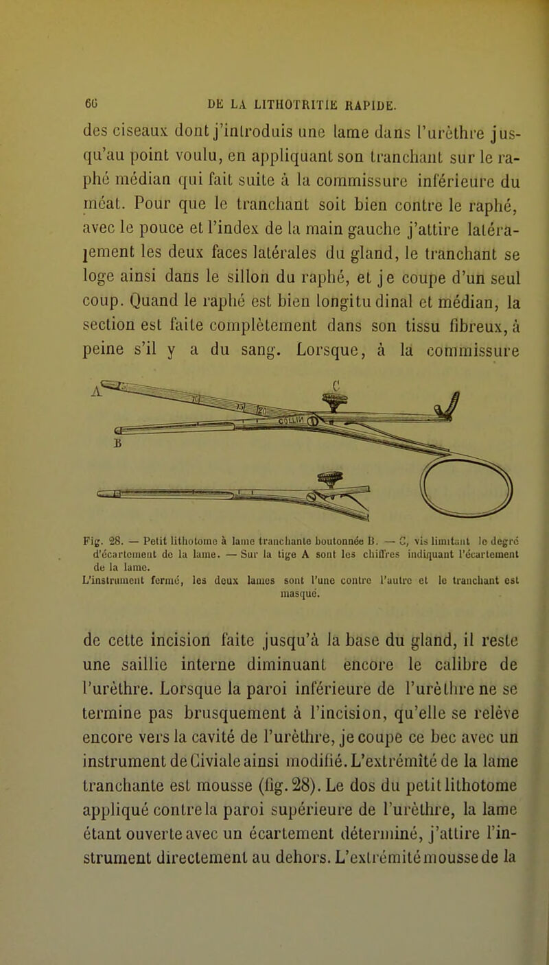 des ciseaux dont j'introduis une lame dans l'urèthre jus- qu'au point voulu, en appliquant son tranchant sur le ra- phc médian qui fait suite à la commissure inlerieure du méat. Pour que le tranchant soit bien contre le raphé, avec le pouce et l'index de la main gauche j'attire latéra- lement les deux faces latérales du gland, le tranchant se loge ainsi dans le sillon du raphé, et je coupe d'un seul coup. Quand le raphé est bien longitudinal et médian, la section est faite complètement dans son tissu fibreux, à peine s'il y a du sang. Lorsque, à la commissure Fig. 28. — Petit litliotoino à lame tranchante boutonnée li. — C, vis limituiil le degré d'ccartcnient de la lame. — Sur la tijje A sont les cliiflVes indiquant l'ccartemenl de la lame. L'instrinuciit ferme, les deux laïucs sont l'une contre l'autre et le tranchant est masque. de cette incision faite jusqu'à la base du gland, il reste une saillie interne diminuant encore le calibre de l'urèthre. Lorsque la paroi inférieure de l'urèthre ne se termine pas brusquement à l'incision, qu'elle se relève encore vers la cavité de l'urèthre, je coupe ce bec avec un instrument de Giviale ainsi modilié. L'extrémité de la lame tranchante est mousse (fig.28). Le dos du petit lithotome appliqué contre la paroi supérieure de l'urèthre, la lame étant ouverte avec un écartement déterminé, j'attire l'in- strument directement au dehors. L'extrémité mousse de la