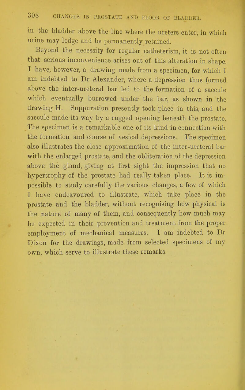 iu the bladder above tlie line where the ureters euter, in which urine may lodge and be permanently retained. Beyond the necessity for regular catheterism, it is not often that serious inconvenience arises out of this alteration in shape. I have, however, a drawing made from a specimen, for which I am indebted to Dr Alexander, where a depression thus formed above the inter-ureteral bar led to the formation of a saccule which eventually burrowed under the bar, as shown in the drawing H. Suppuration presently took place in this, and the saccule made its way by a rugged opening beneath the prostate. The specimen is a remarkable one of its kind in connection with the formation and course of vesical depressions. The specimen also illustrates the close approximation of the inter-ureteral bar with the enlarged prostate, and the obliteration of the depression above the gland, giving at first sight the impression that no hypertrophy of the prostate had really taken place. It is im- possible to study carefully the various changes, a few of which I have endeavoured to illustrate, which take place in the prostate and the bladder, without recognising how physical is the nature of many of them, and consequently how much may be expected in their prevention and treatment from the proper employment of mechanical measures. I am indebted to Dr Dixon for the drawings, made from selected specimens of my own, which serve to illustrate these remarks,