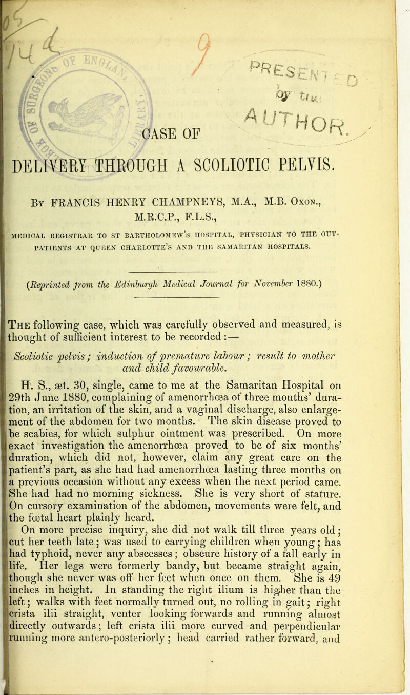 DELIVERY THROUGH A SCOLIOTIC PELVIS. By FRANCIS HENRY CHAMPNEYS, M.A., M.B. Oxon., M.R.C.R, F.L.S., MRDICAL REGISTRAR TO ST BARTHOLOMRW's HOSPITAL, PHYSICIAN TO THE OUT- PATIENTS AT QUEEN charlotte's AND THE SAMARITAN HOSPITALS. {Reprinted Jrom the Edinburgh Medical Journal for November 1880.) The following case, which was carefully observed and measured, is thought of sufficient interest to be recorded :— Scoliotic pelvis ; induction of premature labour; resvlt to mother and child favourable. H. S., 9et. 30, single, came to me at the Samaritan Hospital on 29th June 1880, complaining of amenorrhoea of three months' dura- tion, an irritation of the skin, and a vaginal discharge, also enlarge- ment of the abdomen for two months. The skin disease proved to be scabies, for which sulphur ointment was prescribed. On more exact investigation the amenorrhoea proved to be of six months' duration, which did not, however, claim any great care on the patient's part, as she had had amenorrhoea lasting three months on a previous occasion without any excess when the next period came. She had had no morning sickness. She is very short of stature. On cursory examination of the abdomen, movements were felt, and the foetal heart plainly heard. On more precise inquiry, she did not walk till three years old ,* cut her teeth late; was used to carrying children when young; has had typhoid, never any abscesses ; obscure history of a fall early in life. Her legs were formerly bandy, but became straight again, though she never was off her feet when once on them. She is 49 inches in height. In standing the right ilium is higher than the |left; walks with feet normally turned out, no rolling in gait; right crista ilii straight, venter looking forwards and running almost directly outwards; left crista ilii more curved and perpendicular running more antero-posteriorly; head carried rather forward, and