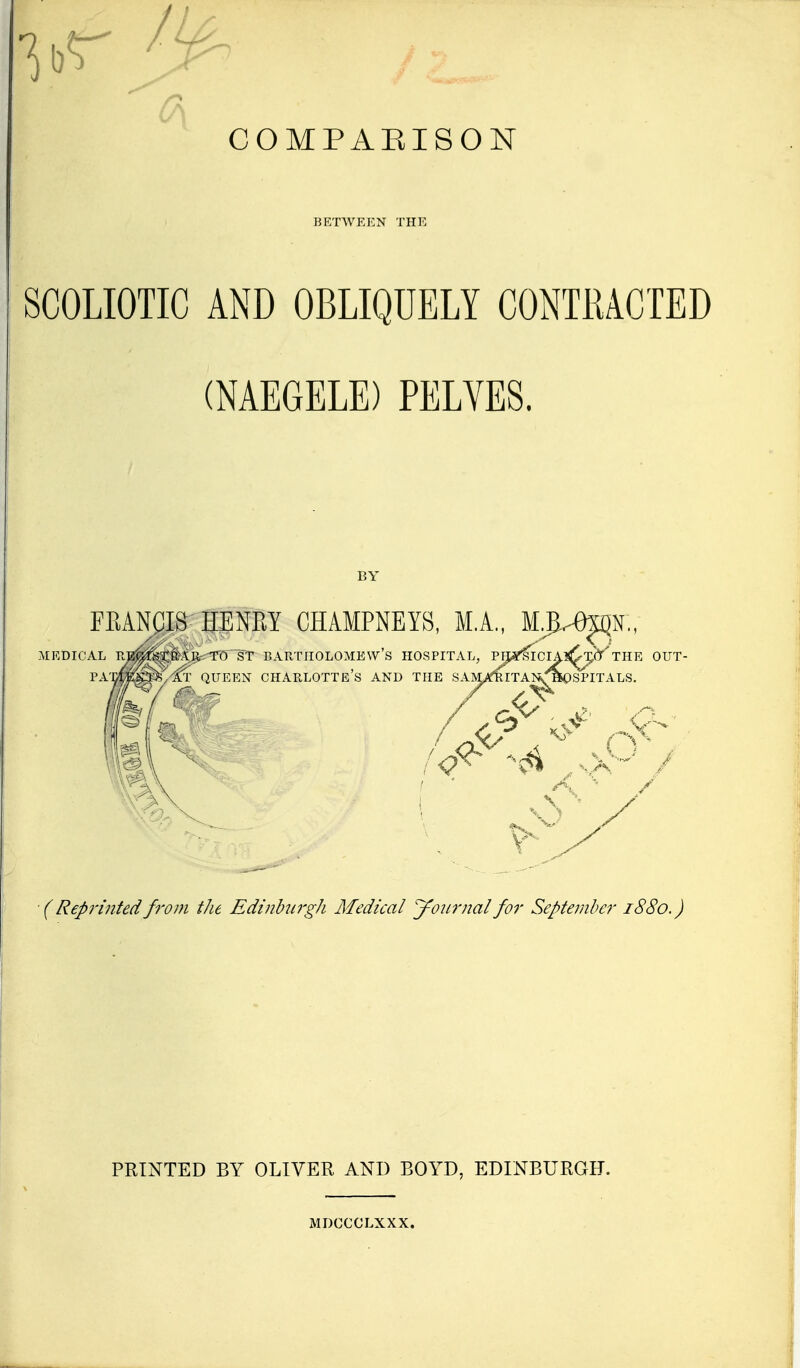 COMPAEISON BETWEEN THE SCOLIOTIC AND OBLIQUELY CONTRACTED (NAEGELE) PELVES. BY ■( Repi'inted fi'om the Edinburgh Medical journal for September 1880.) PRINTED BY OLIVER AND BOYD, EDINBURGH. MDCCCLXXX.