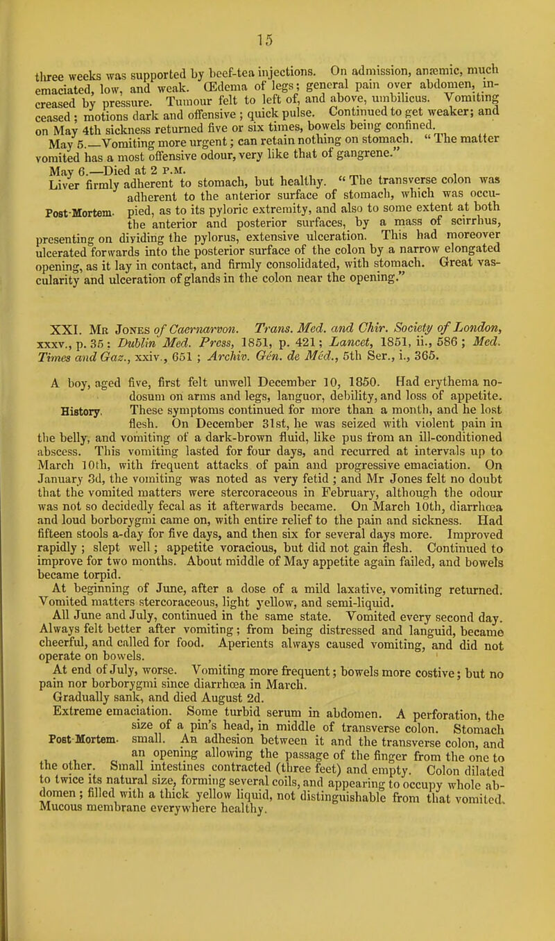tliree weeks was supported by beef-tea injections. On admission, anremic, mucli emaciated, low, and weak. CEdema of legs; general pain over abdomen, in- creased by pressure. Tumour felt to left of, and above, umbilicus. Vomitmg ceased : motions dark and offensive ; quick pulse. Continued to get weaker; and on May 4th sickness returned five or six times, bowels being confined May 5.—Vomiting more urgent; can retain nothing on stomach.  Ihe matter vomited has a most offensive odour, very like that of gangrene. May 6.—Died at 2 p.m. , Liver firmly adherent to stomach, but healthy.  The transverse colon was adherent to the anterior surface of stomach, which was occu- Post-Mortem. pied, as to its pyloric extremity, and also to some extent at both the anterior and posterior surfaces, by a mass of scirrhus, presenting on dividing the pylorus, extensive ulceration. This had moreover ulcerated forwards into the posterior surface of the colon by a narrow elongated opening, as it lay in contact, and firmly consolidated, with stomach. Great vas- cularity and ulceration of glands in the colon near the opening. XXI. Mr Jones of Caernarvon. Trans. Med. and Chir. Society of London, XXXV., p. 35: Dublin Med. Press, 1861, p. 421; Lancet, 1861, ii., 586; Med. Times and Gas., xxiv., 651 ; Archiv. Gen. de Med., 6th Ser., i., 365. A boy, aged five, first felt unwell December 10, 1850. flad erythema no- dosum on arms and legs, languor, debility, and loss of appetite. History. These symptoms continued for more than a month, and he lost flesh. On December 31st, he was seized with violent pain in tlie belly, and vomiting of a dark-brown fluid, like pus from an ill-conditioned abscess. This vomiting lasted for four days, and recurred at intervals up to March 10th, with frequent attacks of pain and progressive emaciation. On January 3d, the vomiting was noted as very fetid ; and Mr Jones felt no doubt that the vomited matters were stercoraceous in February, although the odour was not so decidedly fecal as it afterwards became. On March 10th, diarrhoea and loud borborygmi came on, with entire relief to the pain and sickness. Had fifteen stools a-day for five days, and then six for several days more. Improved rapidly ; slept well; appetite voracious, but did not gain flesh. Continued to improve for two months. About middle of May appetite again failed, and bowels became torpid. At beginning of June, after a dose of a mild laxative, vomiting returned. Vomited matters stercoraceous, light yellow, and semi-liquid. All June and July, continued in the same state. Vomited every second day. Always felt better after vomiting; from being distressed and languid, became cheerful, and called for food. Aperients always caused vomiting, and did not operate on bowels. At end of July, worse. Vomiting more frequent; bowels more costive; but no pain nor borborygmi since diarrhcea in March. Gradually sank, and died August 2d. Extreme emaciation. Some turbid serum in abdomen. A perforation, the size of a pin's head, in middle of transverse colon. Stomach Post Mortem. small. Ah adhesion between it and the transverse colon, and .1. o .0P^l°^ allowing the passage of the finger from the one to the other. Small mtestines contracted (three feet) and empty. Colon dilated to twice its natural size, forming several coils, and appearing to occupy whole ab- domen ; filled with a thick yellow liquid, not distinguishable from that vomited. Mucous membrane everywhere healthy.