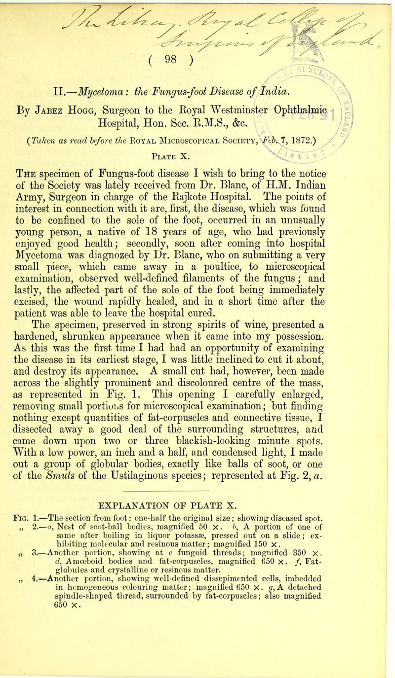 II.—Mycetoma: the Fungus-foot Disease of India. By Jabez Hogg, Surgeon to the Eoyal Westminster Ophthalmic Hospital, Hon. Sec. E.M.S., &c. ' J^j (Taken as read hfore the Eoyal Microscopical Society, Feb^ 1Q12.) y(y Plate X. ^^1;'^~T~ r The specimen of Fungus-foot disease I wish to bring to the notice of the Society was lately received from Dr. Blanc, of H.M. Indian Army, Surgeon in charge of the Kajkote Hospital. The points of interest in connection with it are, first, the disease, which was found to be confined to the sole of the foot, occurred in an unusually young person, a native of 18 years of age, who had previously enjoyed good health; secondly, soon after coming into hospital Mycetoma was diagnozed by Dr. Blanc, who on submitting a very small piece, which came away in a poultice, to microscopical examination, observed well-defined filaments of the fungus; and lastly, the affected part of the sole of the foot being immediately excised, the wound rapidly healed, and in a short time after the patient was able to leave the hospital cured. The specimen, preserved in strong spirits of wine, presented a hardened, shrunken appearance when it came into my possession. As this was the first time I had had an opportunity of examining the disease in its earliest stage, I was little inclined to cut it about, and destroy its appearance. A small cut had, however, been made across the slightly prominent and discoloured centre of the mass, as represented in Fig. 1. This opening I carefully enlarged, removing small portions for microscopical examination; but finding nothing except quantities of fat-corpuscles and connective tissue, I dissected away a good deal of the surrounding structures, and came down upon two or three blackish-looking minute spots. With a low power, an inch and a half, and condensed light, I made out a group of globular bodies, exactly like balls of soot, or one of the Smuts of the Ustilaginous species; represented at Fig. 2, a. EXPLANATION OF PLATE X. Fig. 1.—The section from foot: oBe-balf the original size; showing diseased spot. „ 2.—a, Nest of soot-ball bodies, magnified 50 X. b, A portion of one of same after boiling in liquor potassse, pressed out on a slide; ex- hibiting molecular and resinous matter; magnified 150 X . ,^ 3.—Another portion, showing at c fungoid threads; magnified 350 x. d, Amceboid bodies and fat-corpuscles, magnified 650 x. /, Fat- globules and crystalline or resinous matter. „ 4,—Another portion, showing well-defined dissepimented cells, imbedded in hc mogeneous colouring matter; magnified 650 x. A detached spindle-shaped thread, surrounded by fat-corpuscles; also magnified 650 X.