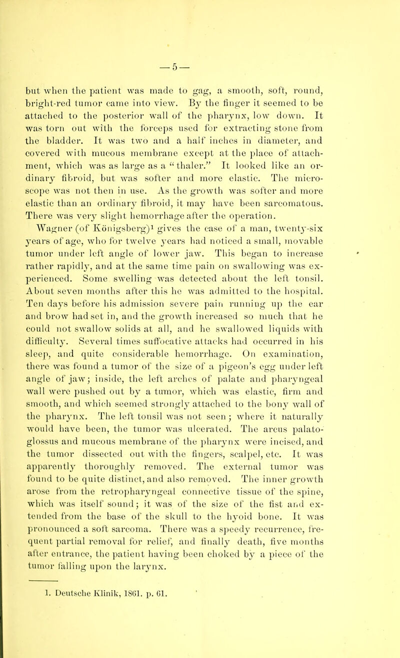 but when llie patient vvjis made to gag, a smc^oth, soft, round, bright-red tunnor canne into view. By the linger it seemed to be attached to the posterior wall of the pharynx, low down. It was torn out with the ibreeps used for extracting stone from the bladder. It was two and a half inches in diameter, and covered with mucous membrane except at the place of attach- ment, which was as large as a  thaler. It looked like an or- dinaiy fibroid, but was softer and more elastic. The micro- scope was not then in use. As the growth was softer and more elastic than an ordinarj' fibroid, it may have been sarcomatous. There was very slight hemorrhage after the operation. Wagner (of K6nigsbcrg)i gives the case of a man, t\vent3-six years of age, who for twelve years had noticed a small, movable tumor under left angle of lower jaw. This began to increase rather rapidly, and at the same time pain on swallowing was ex- perienced. Some swelling was detected about the letl tonsil. About seven months after this he was admitted to the hospital. Ten days before his admission severe pain running up the ear and brow had set in, and the growth increased so much that he could not swallow solids at all, and he swallowed liquids with difficulty. Several times sufl'ocative attacks had occurred in his sleep, and quite considerable hemorrhage. On examination, there was found a tumor of the size of a pigeon's egg under left angle of jaw; inside, the left arches of palate and jjharyngeal wall were pushed out by a tumor, which was elastic, firm and smooth, and which seemed strongly attached to the bony wall of the pharj'nx. The left tonsil was not seen ; where it naturally would have been, the tumor was ulcerated. The arcus palato- glossus and mucous membrane of the phaiynx were incised, and the tumor dissected out with the fingers, scalpel, etc. It was apparently thoroughly removed. The external tumor was found to be quite distinct, and also removed. The inner growth arose from the retropharyngeal connective tissue of the spine, which was itself sound; it was of the size of the fist and ex- tended from the base of the skull to the hyoid bone. It was jironounced a soft sarcoma. There was a speedy recurrence, fre- quent partial removal for reliefj and finally death, five months after entrance, the patient having been choked by a piece of the tumor falling upon the huynx. 1. Deutsche Klinik, ISGl. p. Gl.