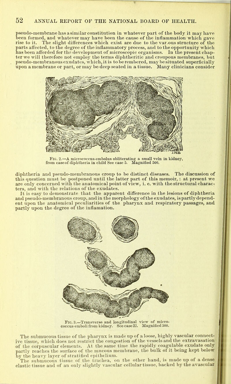 pseudo-membrane ha8 a similar constitution in whatever part of the body it may have been formed, and whatever may have been the cause of the inflammation which gave rise to it. The slight differences which exist are due to the var.ous structure of the parts afi'ected, to the degree of the inflammatory process, and to the opportunity which has been afforded for the development of microscopic organisms. In the present chap- ter we will therefore not employ the terms diphtheritic and croupous membranes, but pseudo-membranous exudates, which, it is to be rembered, may be situated superficially upon a membrane or part, or may be deep seated in a tissue. Many clinicians consider Fig. 2.—A microeoccus-embolna obliteratiug a small vein in kidney, from case of diphtheria in child See case 5. Magnified 500. diphtheria and pseudo-membranous croup to be distinct diseases. The discussion of this question must be postponed until the latter part of this memoir, : at present we are only concerned with the anatomical point of view, i. e. with the structural charac- ters, and with the relations of the exudates. It is easy to demonstrate that the apparent difference in the lesions of diphtheria and pseudo-membranous croup, and in the morphology of the exudates, is partly depend- ent upon the anatomical peculiarities of the pharynx and respiratory passages, and partly upon the degree of the inflamation. Fig. 3.—Transverse and longitudinal view of micro- coccus-emholi from tidney. See case 22. Magnified 300. The submucous tissue of the pharynx is made up of a loose, highly vascular connect- ive tissue, which does not restrict the congestion of the vessels and the extravasation of the corpuscular elements. At the same time the rapidly coagulable exudate only partly reaches the surface of the mucous membrane, the bulk of it being kept below by the heavy layer of stratified epithelium. The submucous tissue of the trachea, on the other hand, is made up of a dense elastic tissue and of an only slightly vascular cellular tissue, backed by the avascular