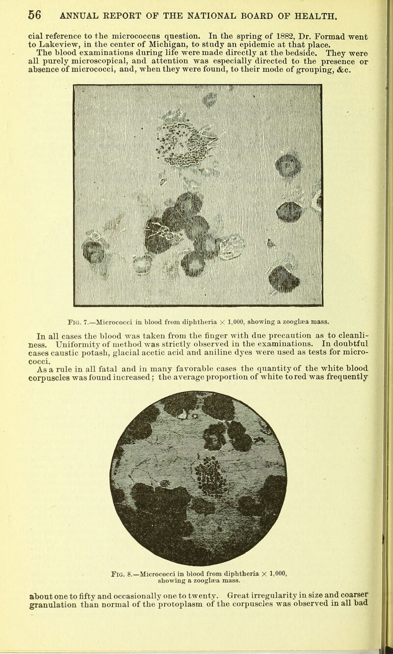 cial reference to the micrococcns question. In the spring of 1882, Dr. Formad went to Lakeview, in the center of Michigan, to study an epidemic at that place. The blood examinations during life were made directly at the bedside. They were all purely microscopical, and attention was especially directed to the presence or absence of micrococci, and, when they were found, to their mode of grouping, &c. Fig. 7.—Micrococci in blood from diphtheria X 1,000, showing a zooglaea mass. In all cases the blood was taken from the finger with due precaution as to cleanli- ness. Uniformity of method was strictly observed in the examinations. In doubtful cases caustic potash, glacial acetic acid and aniline dyes were used as tests for micro- cocci. As a rule in all fatal and in many favorable cases the quantity of the white blood corpuscles was found increased; the average proportion of white to red was frequently Fig. 8.—Micrococci in hlood from diphtheria X 1,000, showing a zooglsea mass. about one to fifty and occasionally one to twenty. Great irregularity in size and coarser granulation than normal of the protoplasm of the corpuscles was observed in all bad