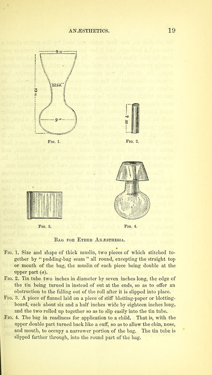 Fig. 3. Fig. 4. Bag foe Ethee Anesthesia. Fig. 1. Size and shape of thick muslin, two pieces of which stitched to- gether by  pudding-bag seam  all round, excepting the straight top or mouth of the bag, the muslin of each piece being double at the upper part (a). Fig. 2. Tin tube two inches in diameter by seven inches long, the edge of the tin being turned in instead of out at the ends, so as to offer an obstruction to the falling out of the roll after it is slipped into place. Fig. 3. A piece of flannel laid on a piece of stiff blotting-paper or blotting- board, each about six and a half inches wide by eighteen inches long, and the two rolled up together so as to slip easily into the tin tube. Fig. 4. The bag in readiness for application to a child. That is, with the upper double part turned back like a cuff, so as to allow the chin, nose, and mouth, to occupy a narrower portion of the bag. The tin tube is slipped farther through, into the round part of the bag.