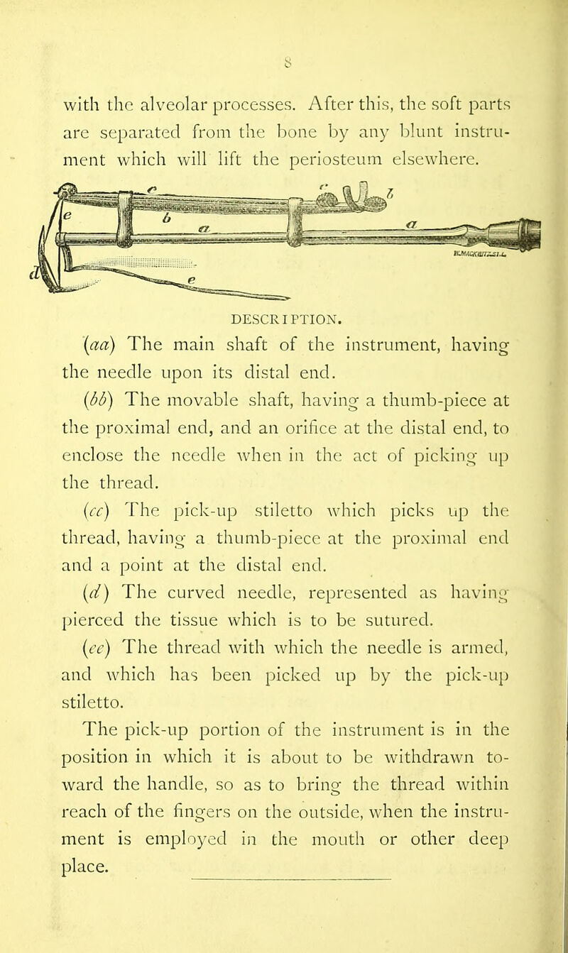 with the alveolar processes. After this, the soft parts are separated from the bone by any blunt instru- ment which will lift the periosteum elsewhere. DESCRIPTION. \aa) The main shaft of the instrument, having the needle upon its distal end. (bb) The movable shaft, having a thumb-piece at the proximal end, and an orifice at the distal end, to enclose the needle when in the act of picking up the thread. (cc) The pick-up stiletto which picks up the thread, having a thumb-piece at the proximal end and a point at the distal end. (d) The curved needle, represented as having pierced the tissue which is to be sutured. (cc) The thread with which the needle is armed, and which has been picked up by the pick-up stiletto. The pick-up portion of the instrument is in the position in which it is about to be withdrawn to- ward the handle, so as to bring the thread within reach of the fingers on the outside, when the instru- ment is employed in the mouth or other deep place.