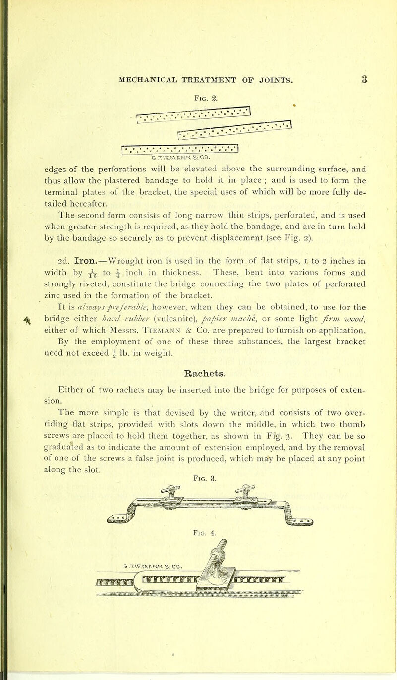 Fig. 2. G ,1MM)N 'U CO. edges of the perforations will be elevated above the surrounding surface, and thus allow the plastered bandage to hold it in place ; and is used to form the terminal plates of the bracket, the special uses of which will be more fully de- tailed hereafter. The second form consists of long narrow thin strips, perforated, and is used when greater strength is required, as they hold the bandage, and are in turn held by the bandage so securely as to prevent displacement (see Fig. 2). 2d. Iron.—Wrought iron is used in the form of flat strips, 1 to 2 inches in width by T\- to \ inch in thickness. These, bent into various forms and strongly riveted, constitute the bridge connecting the two plates of perforated zinc used in the formation of the bracket. It is always preferable, however, when they can be obtained, to use for the bridge either hard rubber (vulcanite), papier maclie, or some light firm wood, either of which Messrs. TlEMANN & Co. are prepared to furnish on application. By the employment of one of these three substances, the largest bracket need not exceed h lb. in weight. Rachets. Either of two rachets may be inserted into the bridge for purposes of exten- sion. The more simple is that devised by the writer, and consists of two over- riding flat strips, provided with slots down the middle, in which two thumb screws are placed to hold them together, as shown in Fig. 3. They can be so graduated as to indicate the amount of extension employed, and by the removal of one of the screws a false joint is produced, which may be placed at any point along the slot. Fig. 3.