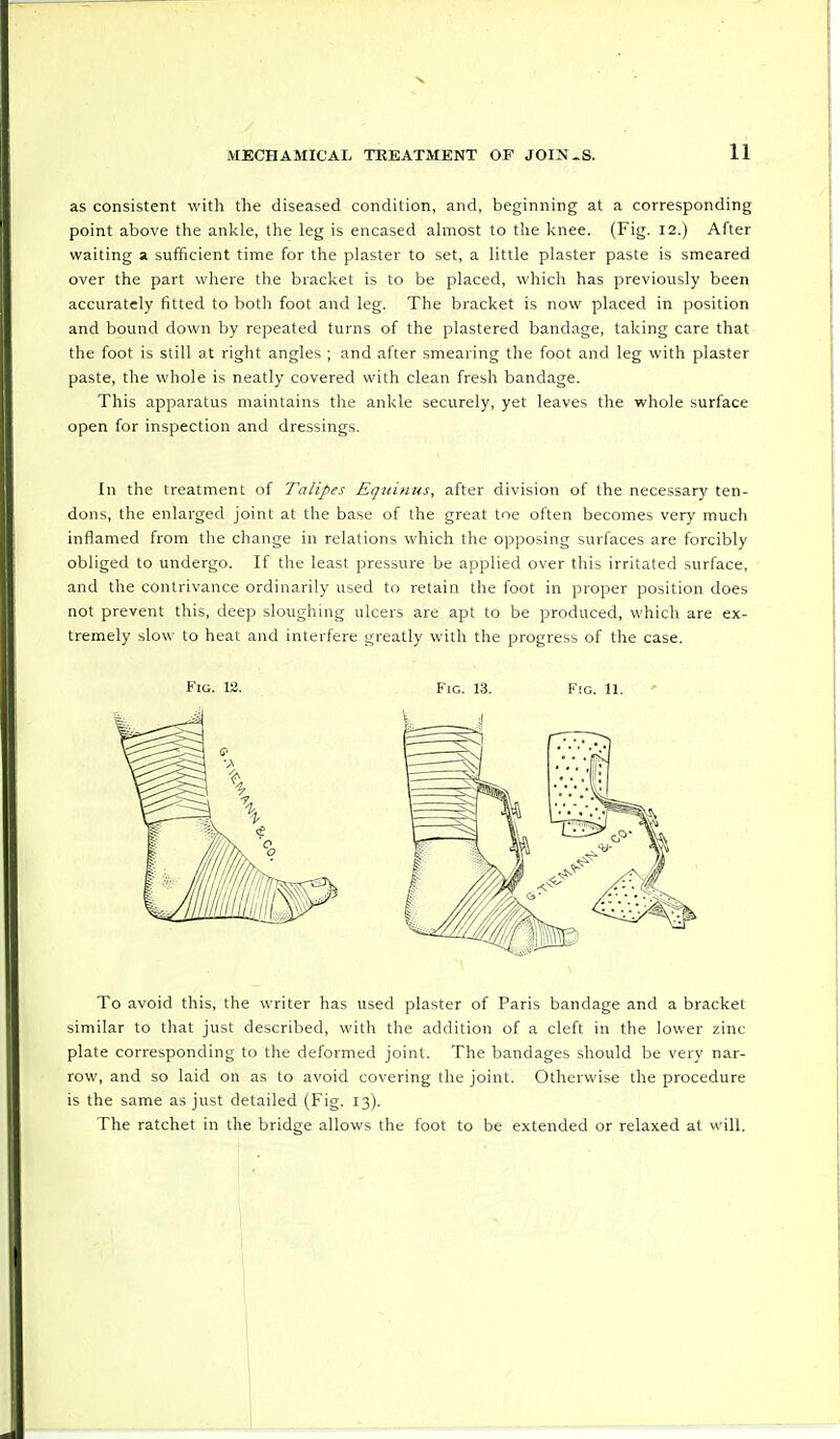 as consistent with the diseased condition, and, beginning at a corresponding point above the ankle, the leg is encased almost to the knee. (Fig. 12.) After waiting a sufficient time for the plaster to set, a little plaster paste is smeared over the part where the bracket is to be placed, which has previously been accurately fitted to both foot and leg. The bracket is now placed in position and bound down by repeated turns of the plastered bandage, taking care that the foot is still at right angles ; and after smearing the foot and leg with plaster paste, the whole is neatly covered with clean fresh bandage. This apparatus maintains the ankle securely, yet leaves the whole surface open for inspection and dressings. In the treatment of Talipes Equinus, after division of the necessary ten- dons, the enlarged joint at the base of the great toe often becomes very much inflamed from the change in relations which the opposing surfaces are forcibly obliged to undergo. If the least pressure be applied over this irritated surface, and the contrivance ordinarily used to retain the foot in proper position does not prevent this, deep sloughing ulcers are apt to be produced, which are ex- tremely slow to heat and interfere greatly with the progress of the case. To avoid this, the writer has used plaster of Paris bandage and a bracket similar to that just described, with the addition of a cleft in the lower zinc- plate corresponding to the deformed joint. The bandages should be very nar- row, and so laid on as to avoid covering the joint. Otherwise the procedure is the same as just detailed (Fig. 13). The ratchet in the bridge allows the foot to be extended or relaxed at will.