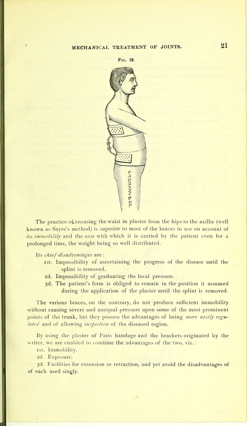 Fig. 18. The practice of.encasing the waist in plaster from the hips to the axilla; (well known as Sayre's method) is superior to most of the braces in use on account of its immobility and the ease with which it is carried by the patient even for a prolonged time, the weight being so well distributed. Its chief disadventages are: ist. Impossibility of ascertaining the progress of the disease until the splint is removed. 2d. Impossibility of graduating the local pressure. 3d. The patient's form is obliged to remain in the position it assumed during the application of the plaster until the splint is removed. The various braces, on the contrary, do not produce sufficient immobility without causing severe and unequal pressure upon some of the most prominent points of the trunk, but they possess the advantages of being more easily regu- lated and of allowing inspection of the diseased region. By using the plaster of Paris bandage and the brackets originated by the writer, we are enabled to combine the advantages of the two, viz. : j st. Immobility. 2d. Exposure. 3d. Facilities for extension or retraction, and yet avoid the disadvantages of of each used singly.