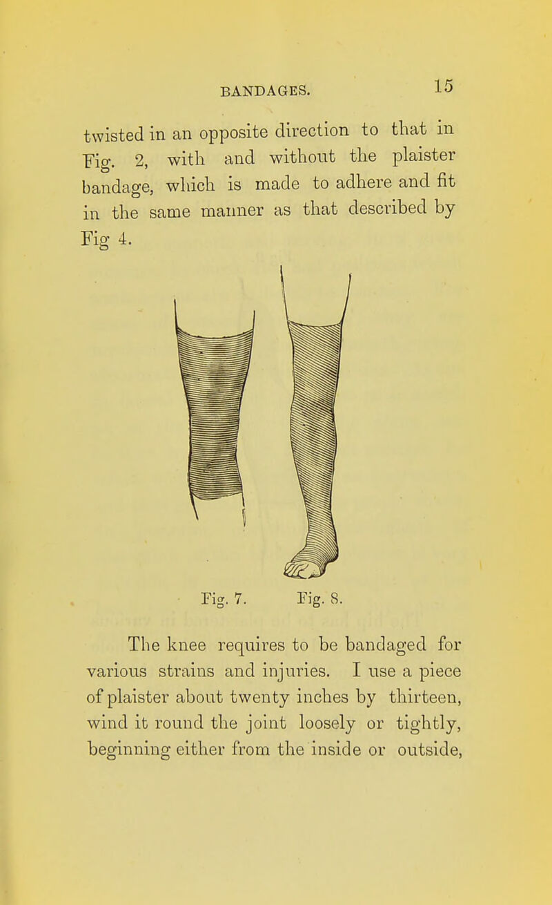 twisted in an opposite direction to that in Fig. 2, with and without the plaister bandage, which is made to adhere and fit in the same manner as that described by Fig 4. rig. 7. rig. 8. The knee requires to be bandaged for various strains and injuries. I use a piece of plaister about twenty inches by thirteen, wind it round the joint loosely or tightly, beginning either from the inside or outside,