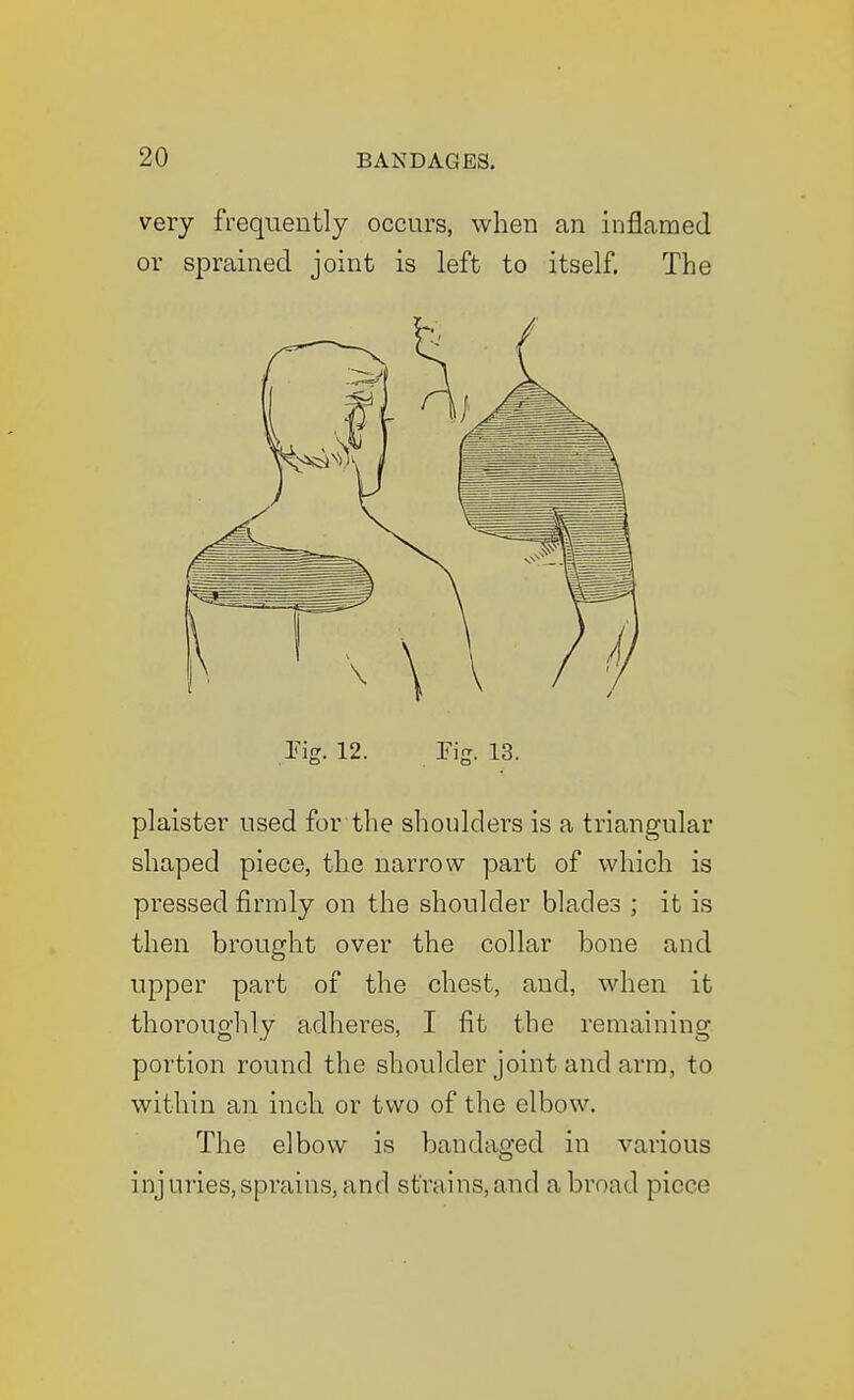 very frequently occurs, when an inflamed or sprained joint is left to itself. The plaister used for the shoulders is a triangular shaped piece, the narrow part of which is pressed firmly on the shoulder blades ; it is then brought over the collar bone and upper part of the chest, and, when it thoroughly adheres, I fit the remaining, portion round the shoulder joint and arm, to within an inch or two of the elbow. The elbow is bandaged in various injuries,sprains,and strains,and abroad piece