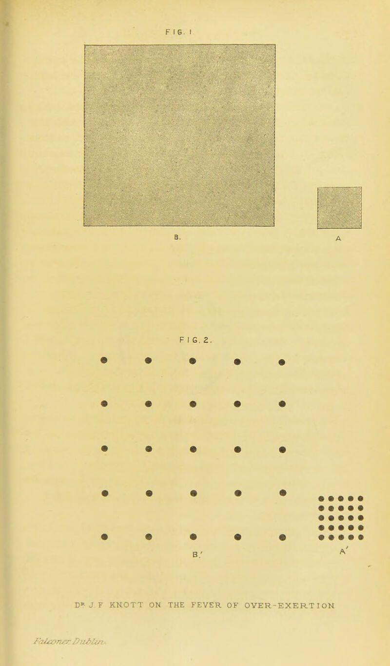 F I G. I D J F KKOTT ON Falconer Biiblut: F I G. 2. • • • • • • • • • • • • • • • FEVER OF OVER-EXERTION