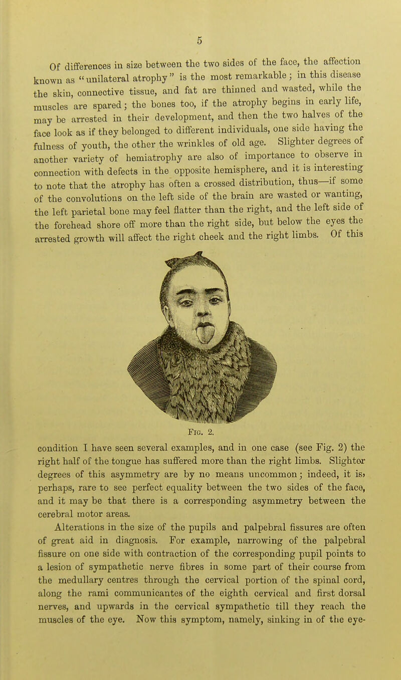 6 Of differences in size between the two sides of the face, the affection known as unilateral atrophy is the most remarkable ; in this disease the skin, connective tissue, and fat are thinned and wasted, while the muscles are spared; the bones too, if the atrophy begins in early life, may be arrested in their development, and then the two halves of the face look as if they belonged to different individuals, one side having the fulness of youth, the other the wrinkles of old age. Slighter degrees of another variety of hemiatrophy are also of importance to observe in connection with defects in the opposite hemisphere, and it is interesting to note that the atrophy has often a crossed distribution, thus—if some of the convolutions on the left side of the brain are wasted or wanting, the left parietal bone may feel flatter than the right, and the left side of the forehead shore off more than the right side, but below the eyes the arrested growth will affect the right cheek and the right limbs. Of this Fig. 2. condition I have seen several examples, and in one case (see Fig. 2) the right half of the tongue has suffered more than the right limbs. Slightor degrees of this asymmetry are by no means uncommon; indeed, it is> perhaps, rare to see perfect equality between the two sides of the face, and it may be that there is a corresponding asymmetry between the cerebral motor areas. Alterations in the size of the pupils and palpebral fissures are often of great aid in diagnosis. For example, narrowing of the palpebral fissure on one side with contraction of the corresponding pupil points to a lesion of sympathetic nerve fibres in some part of their course from the medullary centres through the cervical portion of the spinal cord, along the rami communicantes of the eighth cervical and first dorsal nerves, and upwards in the cervical sympathetic till they reach the muscles of the eye. Now this symptom, namely, sinking in of the eye-