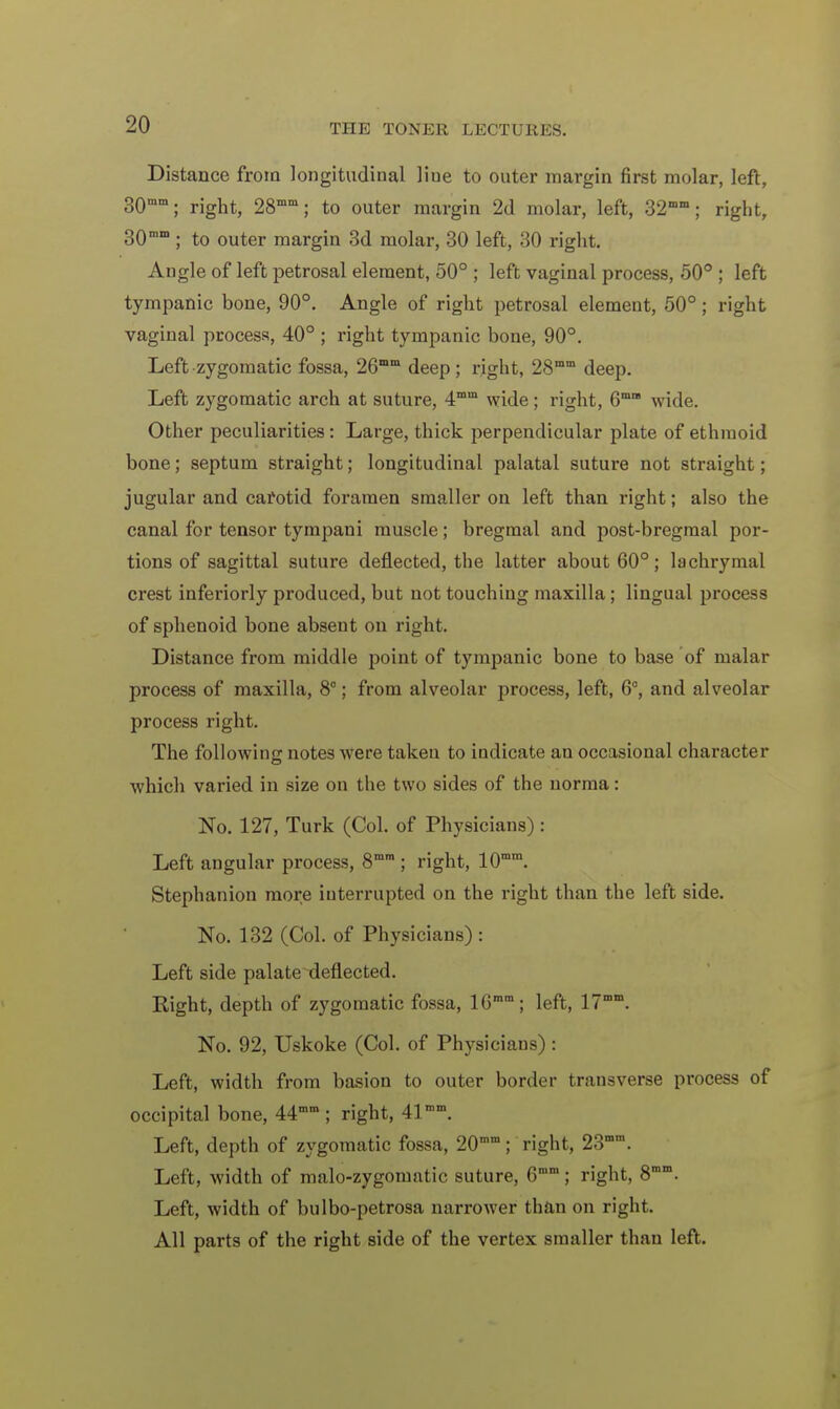 Distance from longitudinal Hue to outer margin first molar, left, 30mm; right, 28mm; to outer margin 2d molar, left, 32mm; right, B0mm ; to outer margin 3d molar, 30 left, 30 right. Angle of left petrosal element, 50° ; left vaginal process, 50° ; left tympanic bone, 90°. Angle of right petrosal element, 50°; right vaginal process, 40° ; right tympanic bone, 90°. Left zygomatic fossa, 26n,m deep ; right, 28mm deep. Left zygomatic arch at suture, 4mm wide ; right, 6ma wide. Other peculiarities: Large, thick perpendicular plate of ethmoid bone; septum straight; longitudinal palatal suture not straight; jugular and carotid foramen smaller on left than right; also the canal for tensor tympani muscle; bregmal and post-bregmal por- tions of sagittal suture deflected, the latter about 60°; lachrymal crest inferiorly produced, but not touching maxilla; lingual process of sphenoid bone absent on right. Distance from middle point of tympanic bone to base of malar process of maxilla, 8°; from alveolar process, left, 6°, and alveolar process right. The following notes were taken to indicate an occasional character which varied in size on the two sides of the norma: No. 127, Turk (Col. of Physicians) : Left angular process, 8mm ; right, 10mm. Stephanion more interrupted on the right than the left side. No. 132 (Col. of Physicians) : Left side palate deflected. Right, depth of zygomatic fossa, 16mm; left, 17mm. No. 92, Uskoke (Col. of Physicians) : Left, width from basion to outer border transverse process of occipital bone, 44mm ; right, 41mm. Left, depth of zygomatic fossa, 20mm; right, 23mra. Left, width of malo-zygomatic suture, 6mm; right, 8rom. Left, width of bulbo-petrosa narrower than on right. All parts of the right side of the vertex smaller than left.