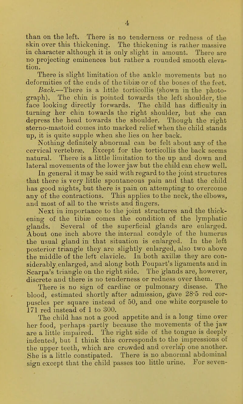 than on the left. There is no tenderness or redness of the skin over this thickening. The thickening is rather massive in character although it is only slight in amount. There are no projecting eminences but rather a rounded smooth eleva- tion. There is slight limitation of the ankle movements but no deformities of the ends of the tibiae or of the boues of the feet. Back.—There is a little torticollis (shown in the photo- graph). The chin is pointed towards the left shoulder, the face looking directly forwards. The child has difficulty in turning her chin towards the right shoulder, but she can depress the head towai'ds the shoulder. Though the right sterno-mastoid comes into marked relief when the child stands up, it is quite supple when she lies on her back. Nothing definitely abnormal can be felt about any of the cervical vertebras. Except for the torticollis the back seems natural. There is a little limitation to the up and down and lateral movements of the lower jaw but the child can chew well. In general it may be said with regard to the joint structures that there is very little spontaneous pain and that the child has good nights, but there is pain on attempting to overcome any of the contractions. This applies to the neck, the elbows, and most of all to the wrists and fingers. Next in importance to the joint structures and the thick- ening of the tibiaB comes the condition of the lymphatic glands. Several of the superficial glands are enlarged. About one inch above the internal condyle of the humerus the usual gland in that situation is enlarged. In the left posterior triangle they are slightly enlarged, also two above the middle of the left clavicle. In both axillae they are con- siderably enlarged, and along both Poupart's ligaments and in Scarpa's triangle on the right side. The glands are, however, discrete and there is no tenderness or redness over them. There is no sign of cardiac or pulmonary disease. The blood, estimated shortly after admission, gave 28-5 red cor- puscles per square instead of 50, and one white coi-puscle to 171 red instead of 1 to 300. The child has not a good appetite and is a long time over her food, perhaps partly because the movements of the jaw are a little impaired. The right side of the tongue is deeply indented, but I think this corresponds to the hnpressions of the upper teeth, which are crowded and overla'p one another. She is a little constipated. There is no abnormal abdominal sign except that the child passes too little urine. For seven-