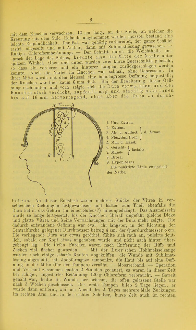 r mit dem Kuocheu verwachsen, 10 cm laug; au der Stelle an welcher die Kreuzun<^ mit dem Sulc. Rolando angenommen werden musste, bestand eine leichte Empfindlichkeit. Der Pat. war gehörig vorbereitet, der ganze Schädel asirt abgeseift und mit Aether, dann mit Sublimatlosung gewaschen. - Rx hi-e diloroformbetäubung. - Der Schnitt durch die Weichtheile ent- fprach der Lage des Sulcus, kreuzte also die Mitte der Narbe unter snitzem Winkel. Oben und unten wurden zwei kurze Querschnitte gemacht, so dass ein vorderer und ein hinterer Lappen zurückgeschlagen werden konnte. Auch die Narbe im Knochen war schmal, ohne Depression In ihrer Mitte wurde mit dem Meissel eine bohnengrosse OefFnung hergestellt; der Knochen war hier kaum 6 mm dick. Bei der Erweiterung dieser Oeß- nung nach unten und vorn zeigte sich die Dura verwachsen und der Knochen stark verdickt, zapfenförmig und stachlig nach innen bis auf 16 mm hervorragend, ohne aber die Dura zu durch- it. \ d. 1. Unt. Extrem. 2. Extens. 3. Ab- u. Adduct. J, d. Armes. 4. Elex. Sup. Fron. J 5. Mm. d. Hand. 6. Gesicht- l 7. Mund- / 8. Broca. 9. Hypoplossiis. Die punktirte Linie eutspricht der Narbe. facialis. bohren. An dieser Enostose waren mehrere Stücke der Vitrea in ver- schiedeneu Richtungen festgewachsen und hatten zum Theil ebenfalls die Dura tief in das Gehirn (in einen Sulcus?) hineingedrängt. Das Ausmeissein wurde so lange fortgesetzt, bis der Knochen überall ungefähr gleiche Dicke und glatte Vitrea und keine Verwachsungen mit der Dura mehr zeigte. Die dadurch entstandene OefFnung war oval; ihr längster, in der Richtung der Centraifurche gelegener Durchmesser betrug 4 cm, der Querdurchmesser 3 cm. Die vorliegende Dura war etwas geröthet, fühlte sich rauh an, pulsirte deut- lich, sobald der Kopf etwas angehoben wurde und nicht nach hinten über- gebeugt lag. Die tiefen Furchen waren nach Entfernung der Riffe und Zacken viel flacher geworden. — Mit der Luer'schen Hohlmeissolzange wurden noch einige scharfe Kanten abgekniffen, die Wunde mit Subliinat- lösuug abgespült, mit Jodoformgaze tamponirt, die Haut bis auf eine OefT- nung in der Mitte (für den Tampon) vernäht. — Moosverband. — Operation und Verband zusammen hatten 2 Stunden gedauert, es waren in dieser Zeit bei ruhiger, ungestörter Betäubung 120 g Chloroform verbraucht. — Soweit genäht war, heilte die W^uude per primain, die offen gelassene Stelle war nach '6 Wochen geschlossen. Der erste Tampon blieb 2 Tage liegen; er wurde dann entfernt, weil am Abend des 2. Tages mehrere Male Zuckungen im rechten Arm und in der rechten Schulter, kurze Zeit auch im rechten