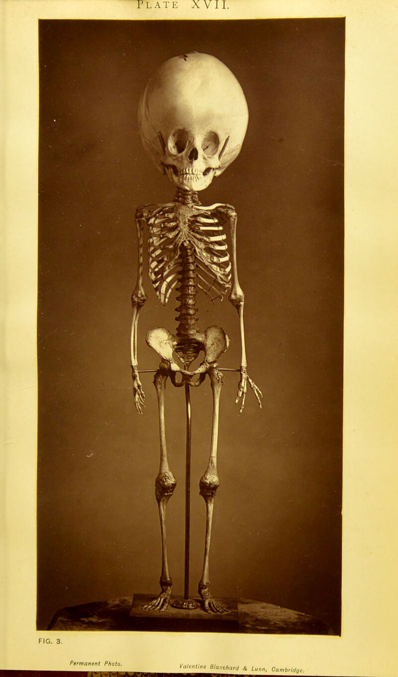 FIG. 3. Permanent Photo, Vulvntine Blanchard A Lunn, CambrUly,