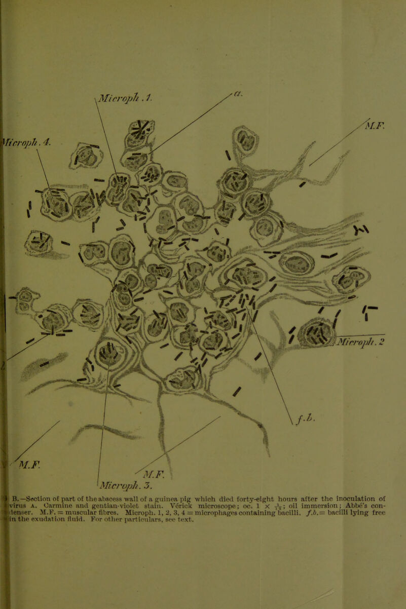 B.—Section of part of the abscess wall of a guinea pig which died forty-eight hours after the inoculation of 'ru8 A. Carmine and gentian-violet stain. Verick microscope; oc. 1 X -j^; oil immersion; Abbe's con- enaer. M.K. = muscular iibres. Microph. 1, 2, 3, 4 = microphages containing bacilli. /.6.= bacilli lying free nthe exudation fluid. Kor otlier particulars, see text.