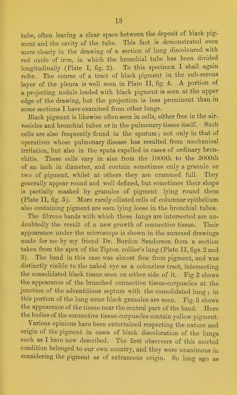 tube, often leaving a clear space between tbe deposit of black pig- ment and the cavity of tbe tube. This fact is demonstrated even more clearly in the drawing of a section of lung discoloured vrith red oxide of iron, in which the bronchial tube has been divided longitudinally (Plate I, fig. 2). To this specimen I shaU again refer. The course of a tract of black pigment in the sub-serous layer of the pleura is well seen in Plate II, fig. 4. A portion of a projecting nodule loaded with black pigment is seen at the upper edge of the drawing, but the projection is less prominent than in some sections I have examined from other lungs. Black pigment is likewise often seen in cells, either free in the air- vesicles and bronchial tubes or in the pulmonary tissue itself. Such cells are also frequently found in the sputum; not only in that of operatives whose pulmonary disease has resulted from mechanical irritation, but also in the sputa expelled in cases of ordinary bron- chitis. These cells vary in size from the 1000th to the 3000th of an inch in diameter, and contain sometimes only a granule or two of pigment, whilst at others they are crammed full. They generally appear roimd and well defined, but sometimes their shape is partially masked by granules of pigment lying round them (Plate II, fig. 5). More rarely ciliated cells of columnar epithelium also containing pigment are seen lying loose in the bronchial tubes. The fibrous bands with which these lungs are intersected are un- doubtedly the result of a new growth of connective tissue. Their appearance under the microscope is shown in the annexed drawings made for me by my friend Dr. Burdon Sanderson from a section taken from the apex of the Tipton collier's lung (Plate II, figs. 2 and 3). The band in this case was almost free from pigment, and was distinctly visible to the naked eye as a colourless tract, intersecting the consolidated black tissue seen on either side of it. Fig 2 shows the appearance of the branched connective tissue-corpuscles at the junction of the adventitious septum with the consolidated lung ; in this portion of the lung some black granules are seen. Fig. 3 shows the appearance of the tissue near the central part of the band. Here the bodies of the connective tissue-corpuscles contain yellow pigment. Various opinions have been entertained respecting the nature and origin of the pigment in cases of black discoloration of the lungs such as I have now described. The first observers of this morbid condition belonged to our own country, and they were unanimous in considering the pigment as of extraneous origin. So long ago as